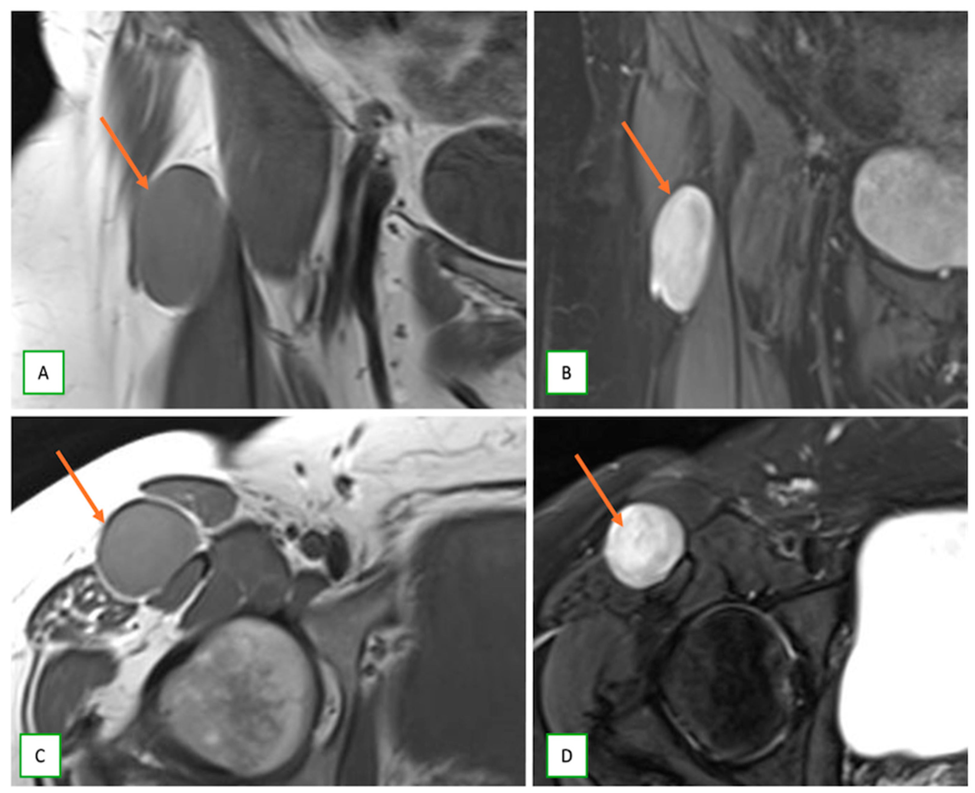 Cancers 17 00246 g017 Cancers 17 00246 g017