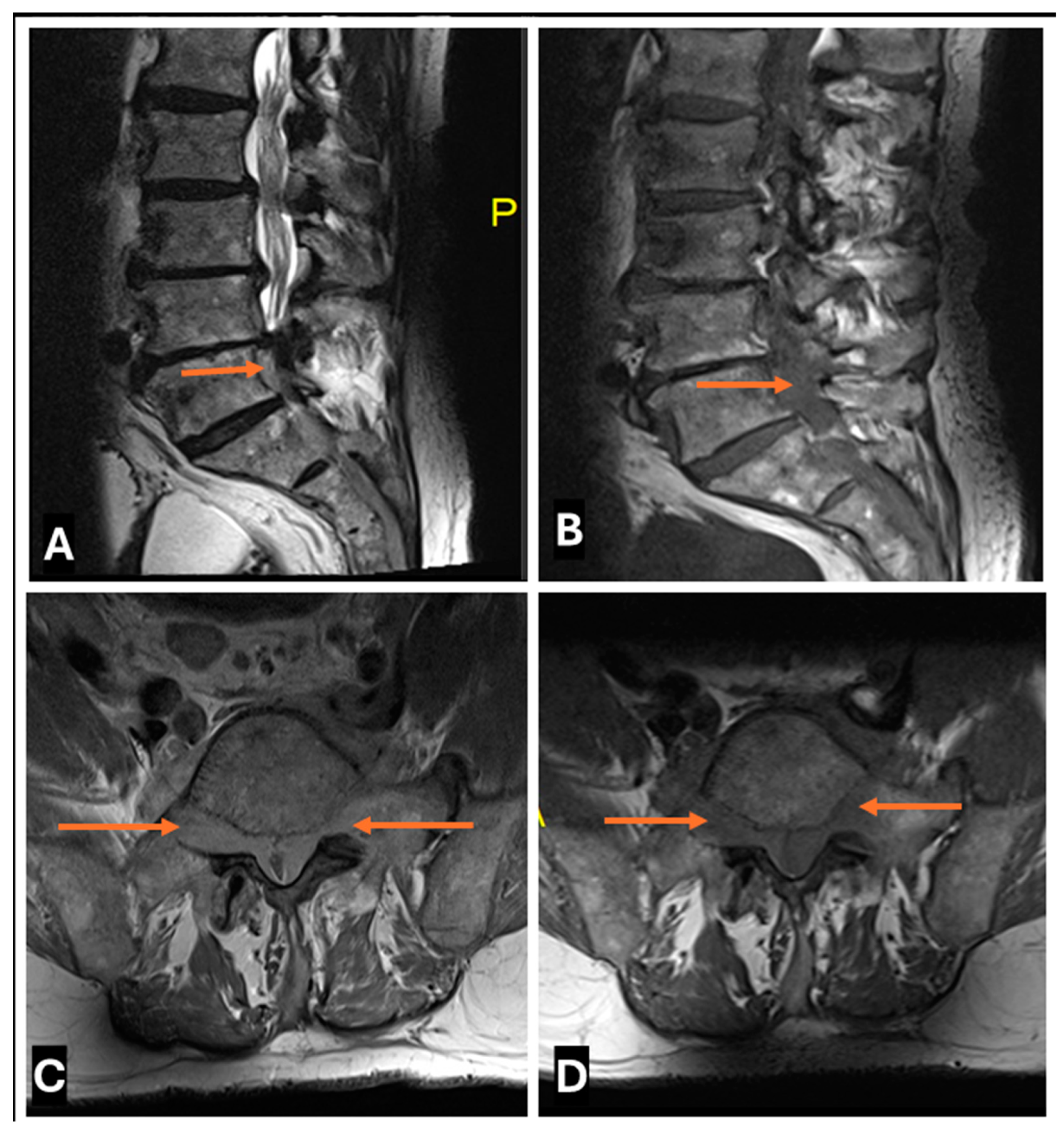 Cancers 17 00246 g021 Cancers 17 00246 g021