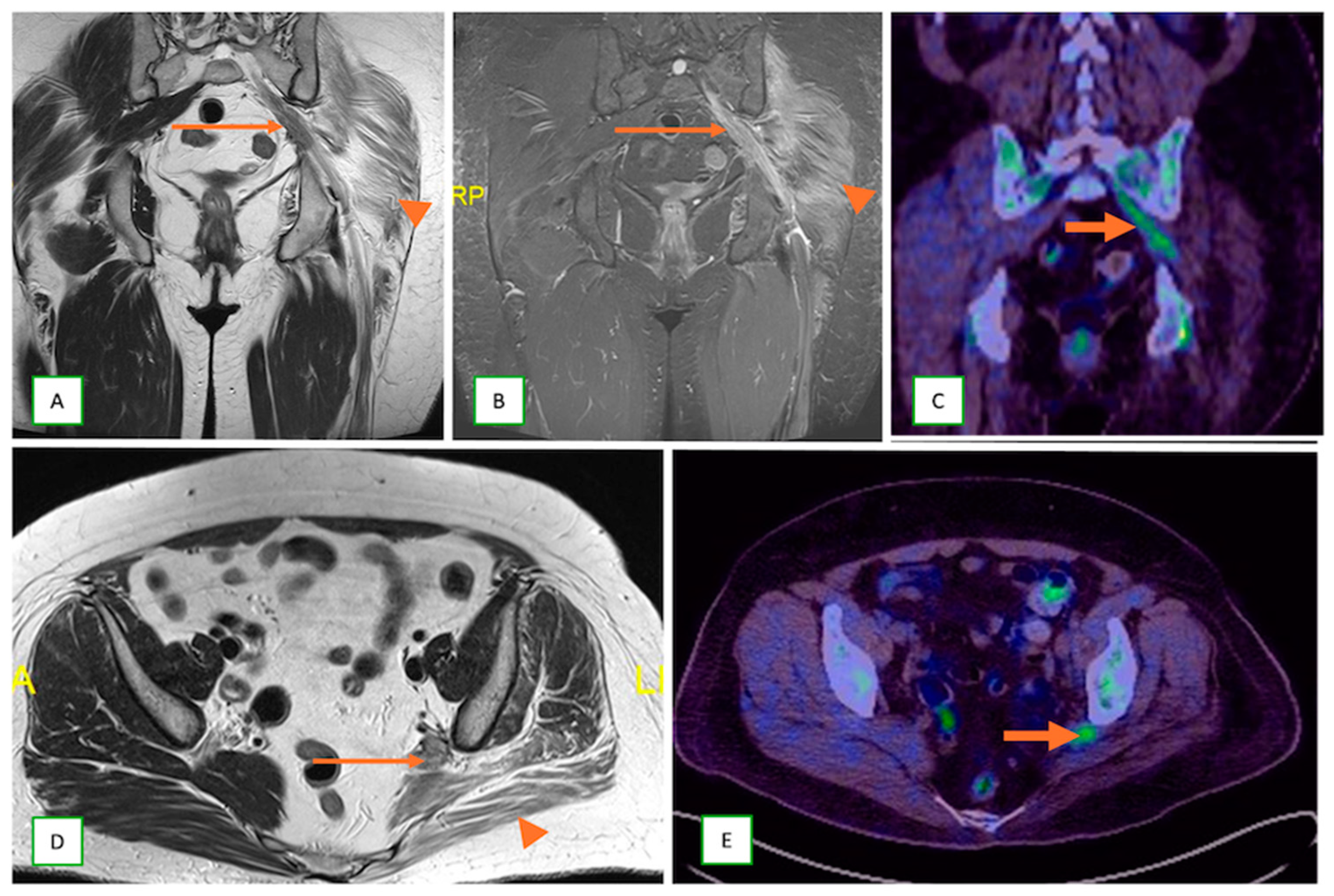 Cancers 17 00246 g024 Cancers 17 00246 g024