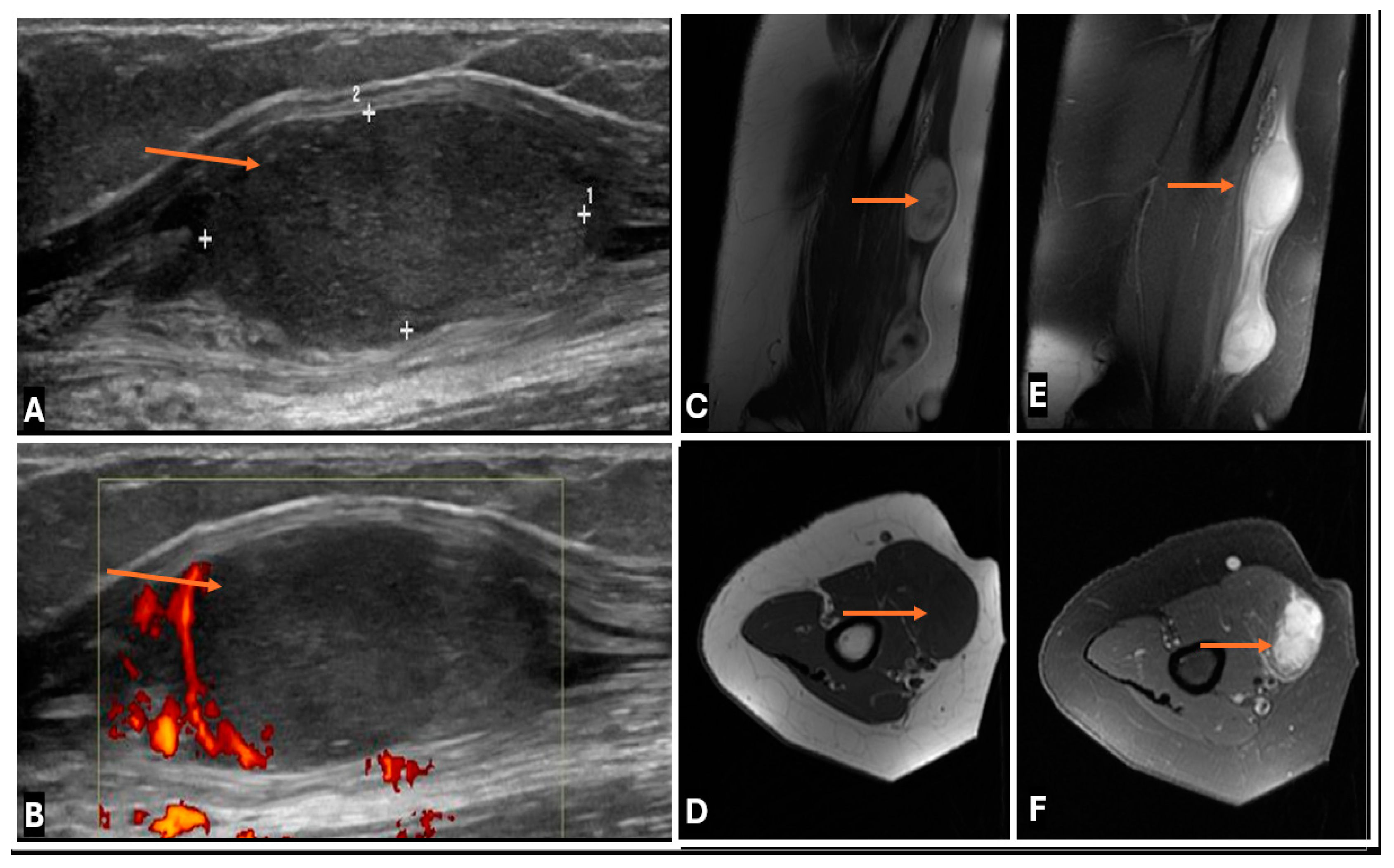 Cancers 17 00246 g027 Cancers 17 00246 g027