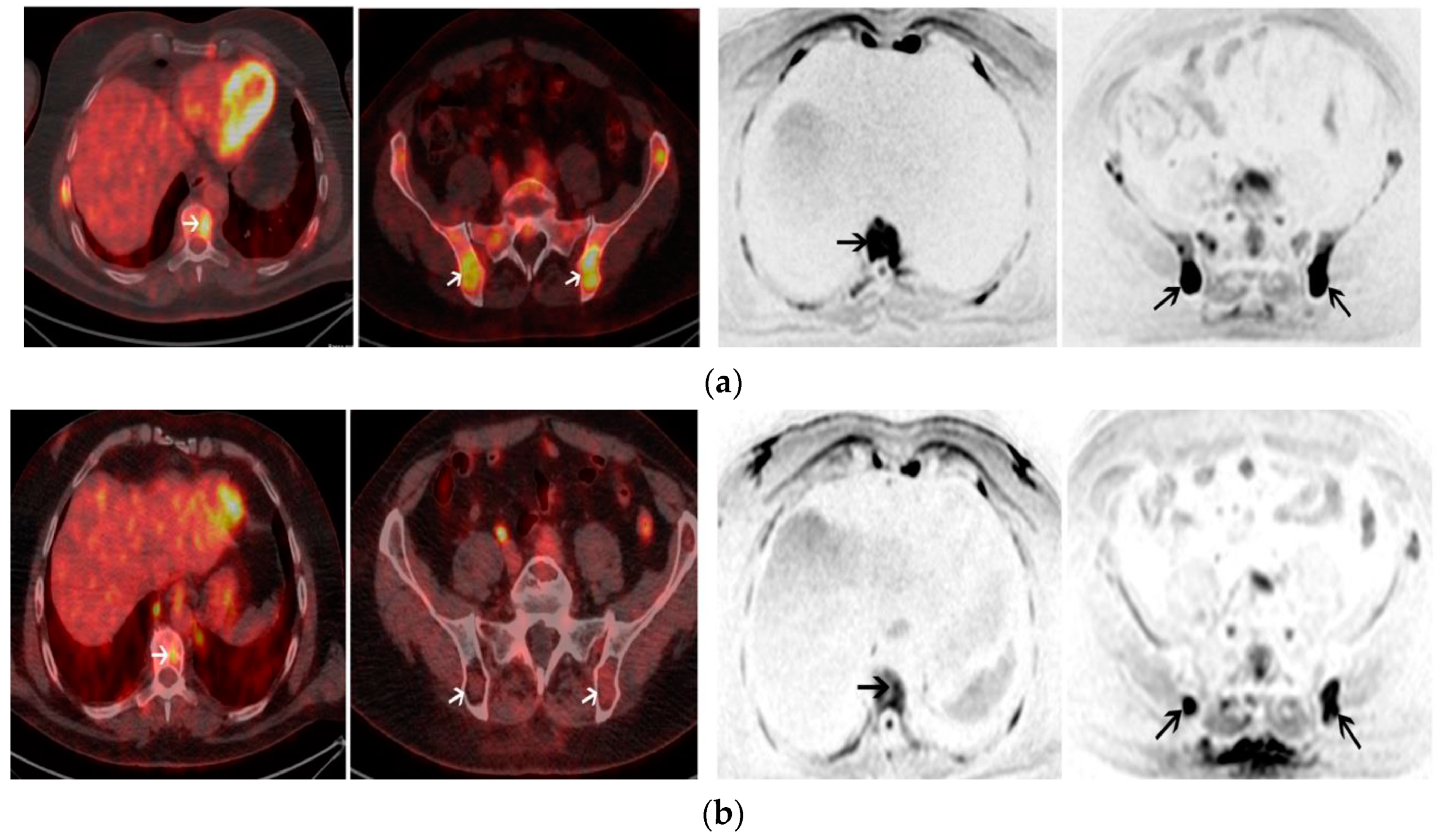 Cancers 17 00275 g002