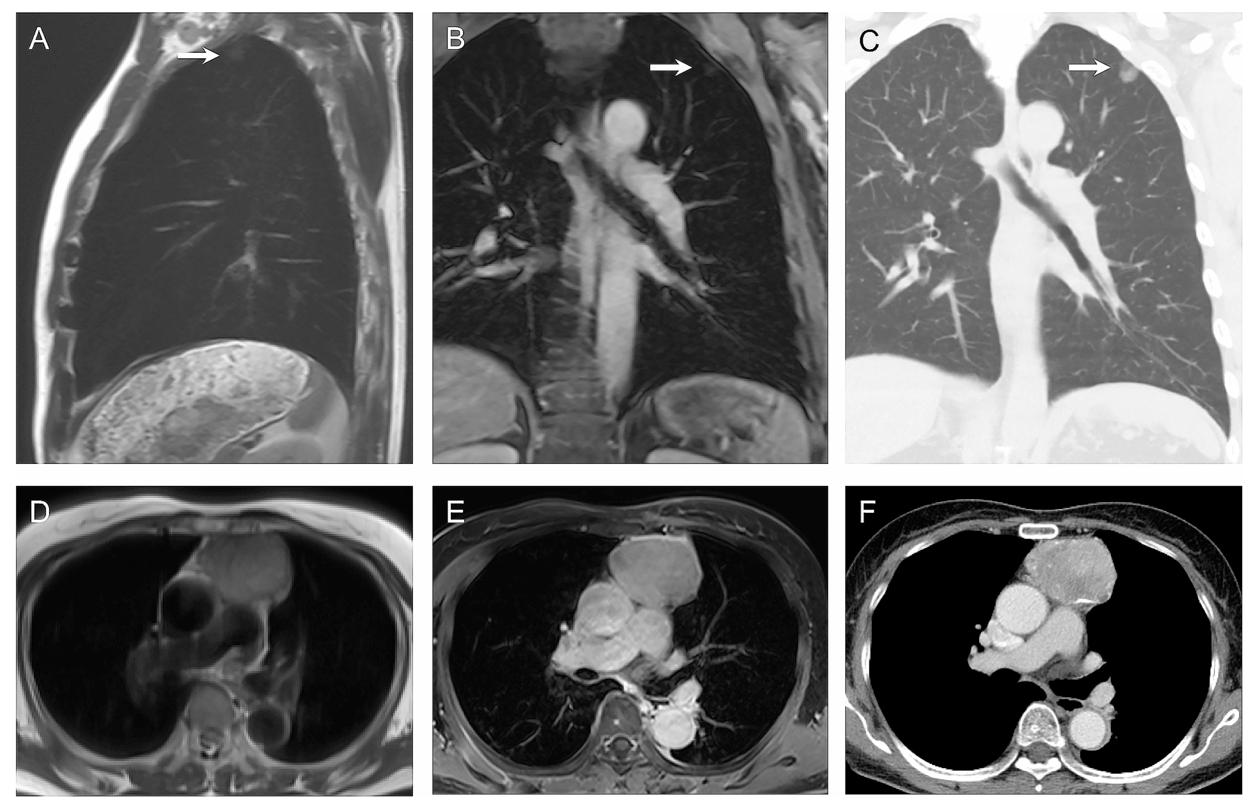 Cancers 17 00275 g003