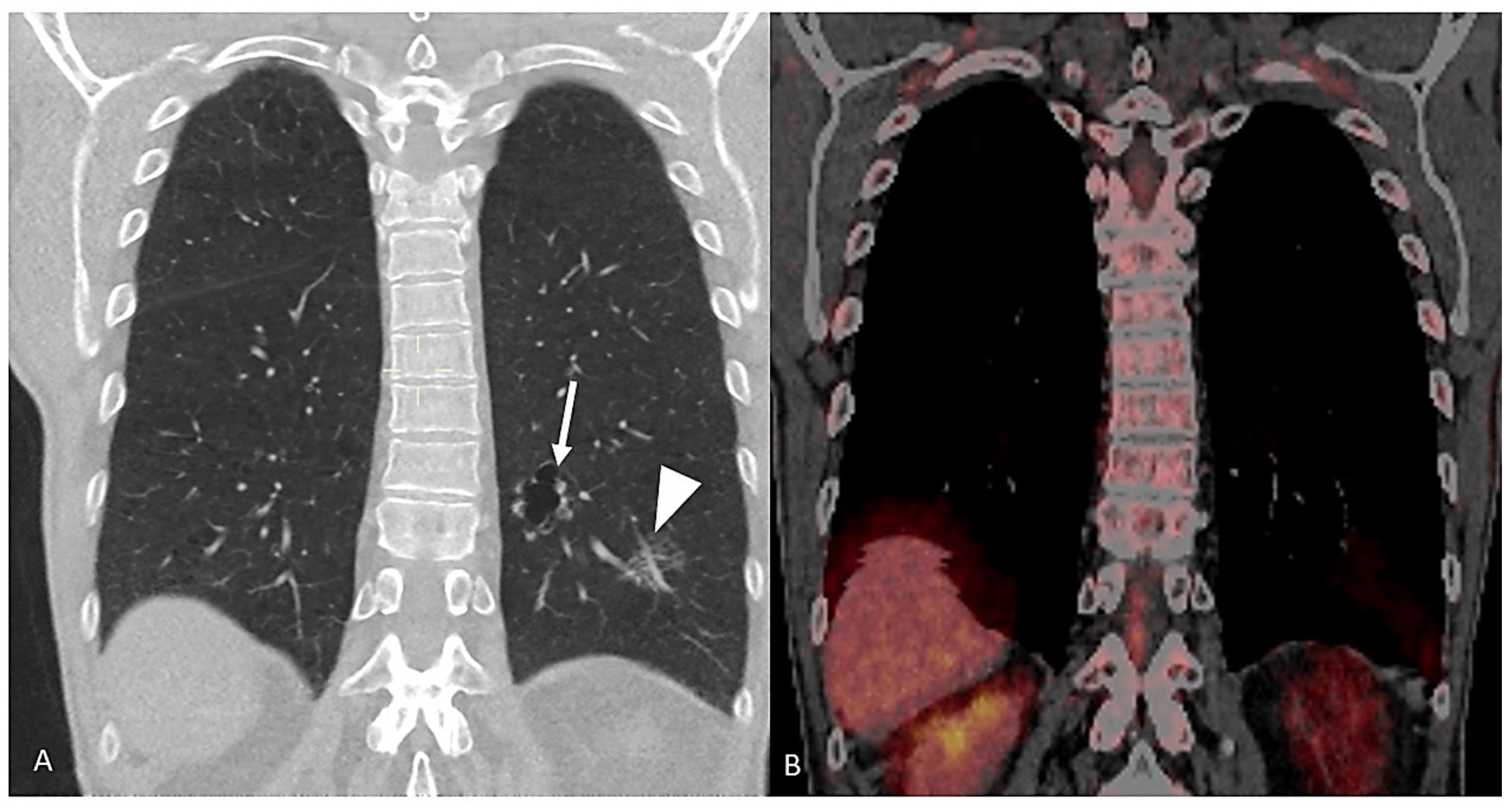 Cancers 17 00307 g001