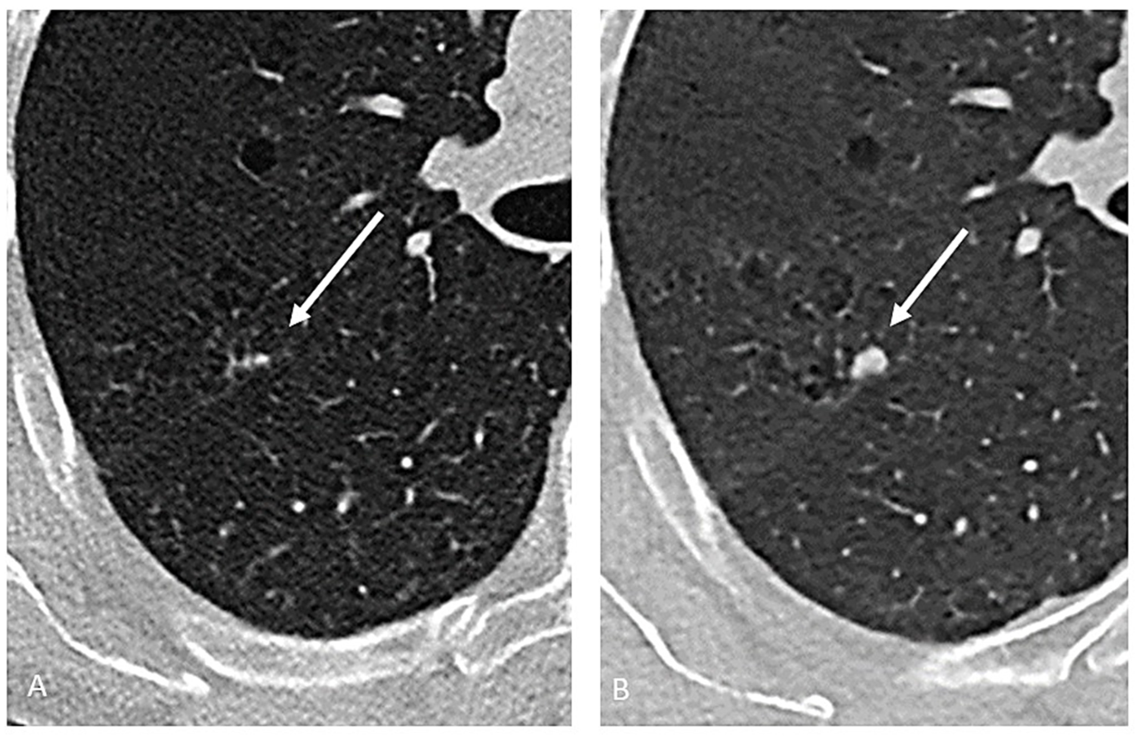 Cancers 17 00307 g002