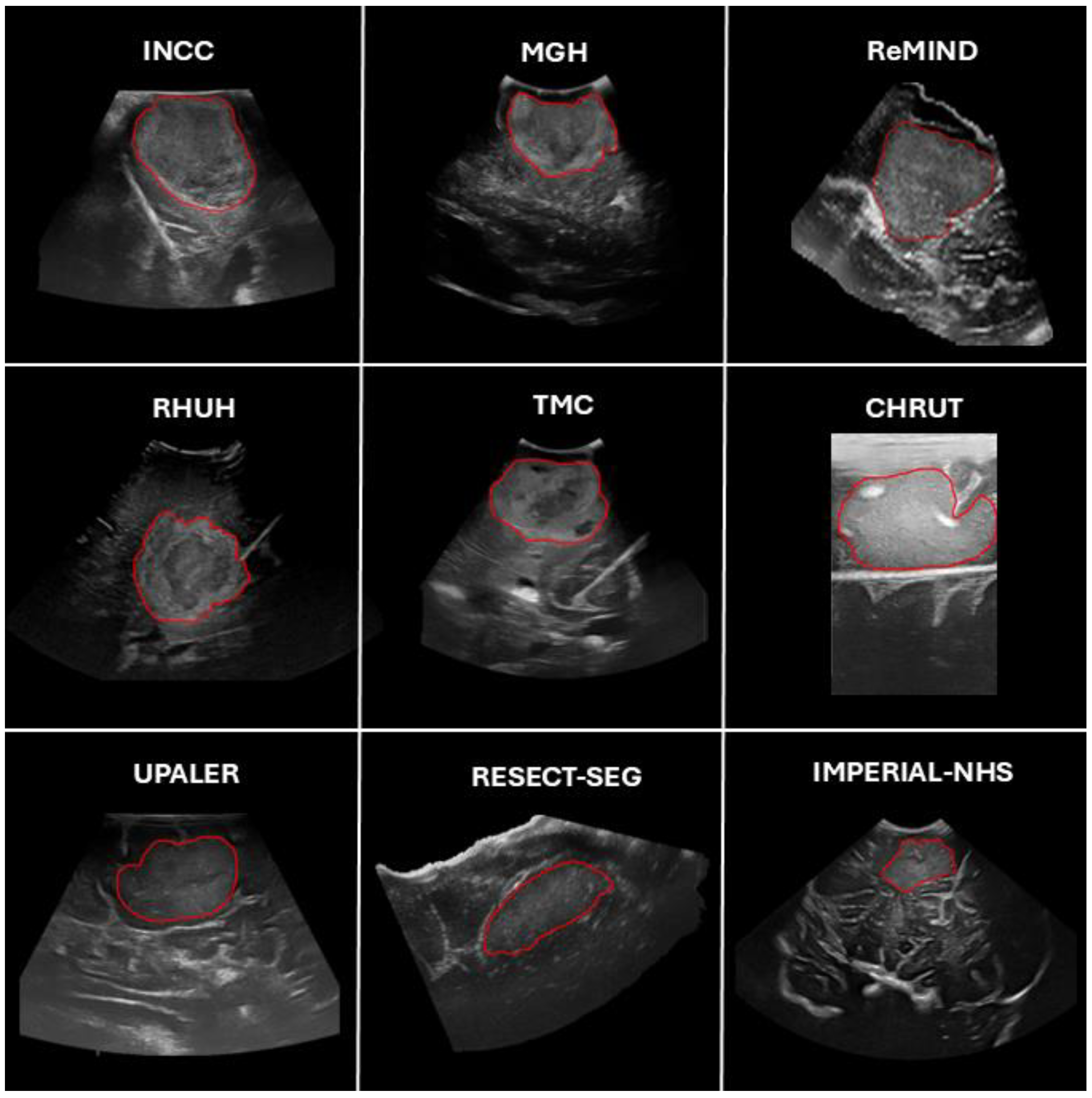 Cancers 17 00315 g002
