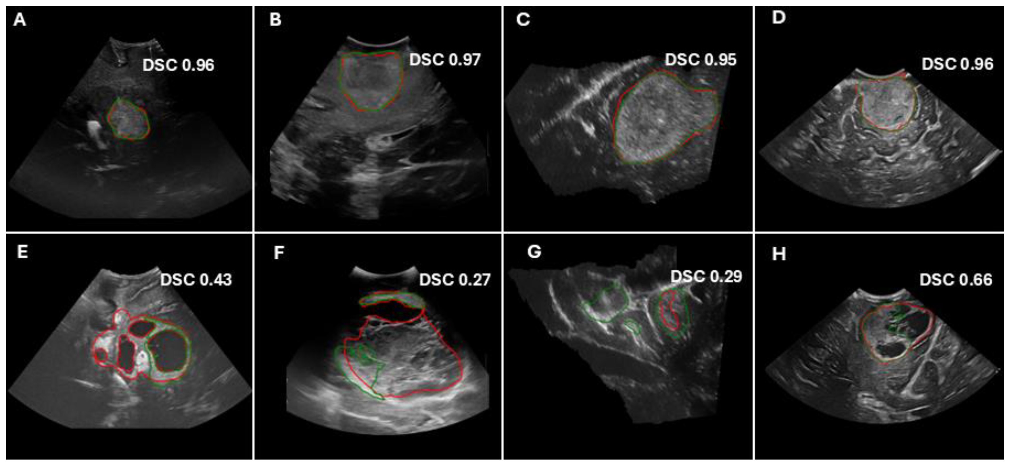 Cancers 17 00315 g004