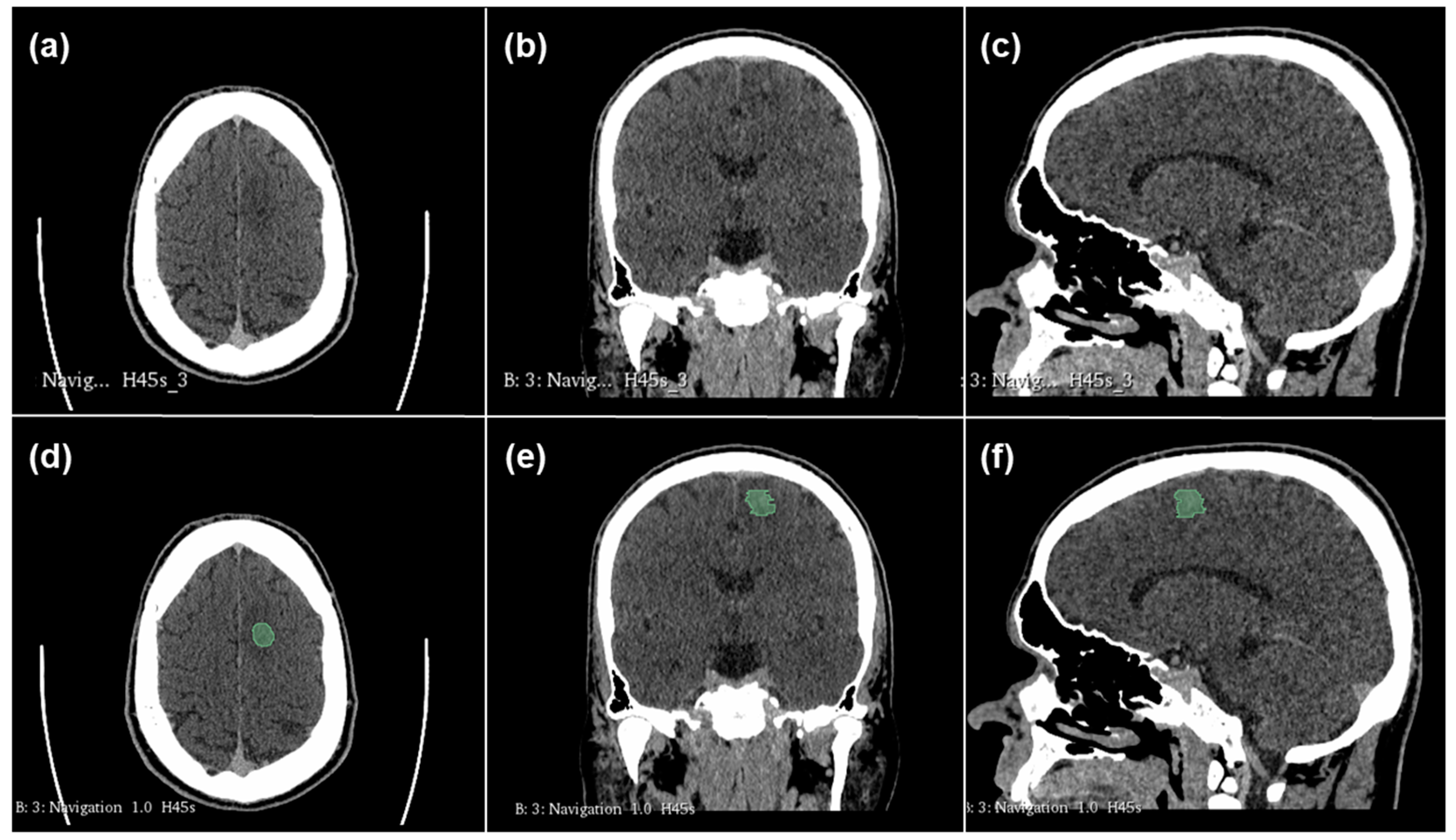 Cancers 17 00322 g001