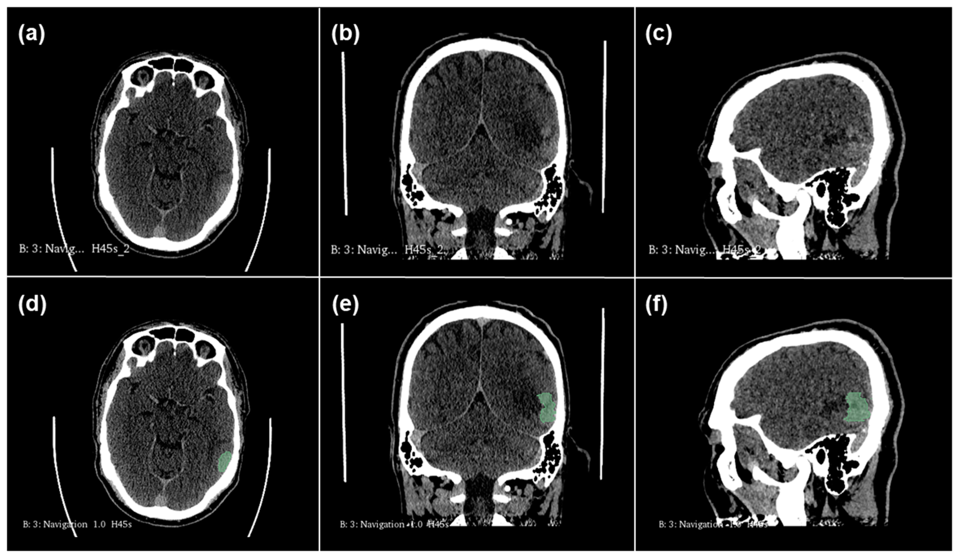 Cancers 17 00322 g002