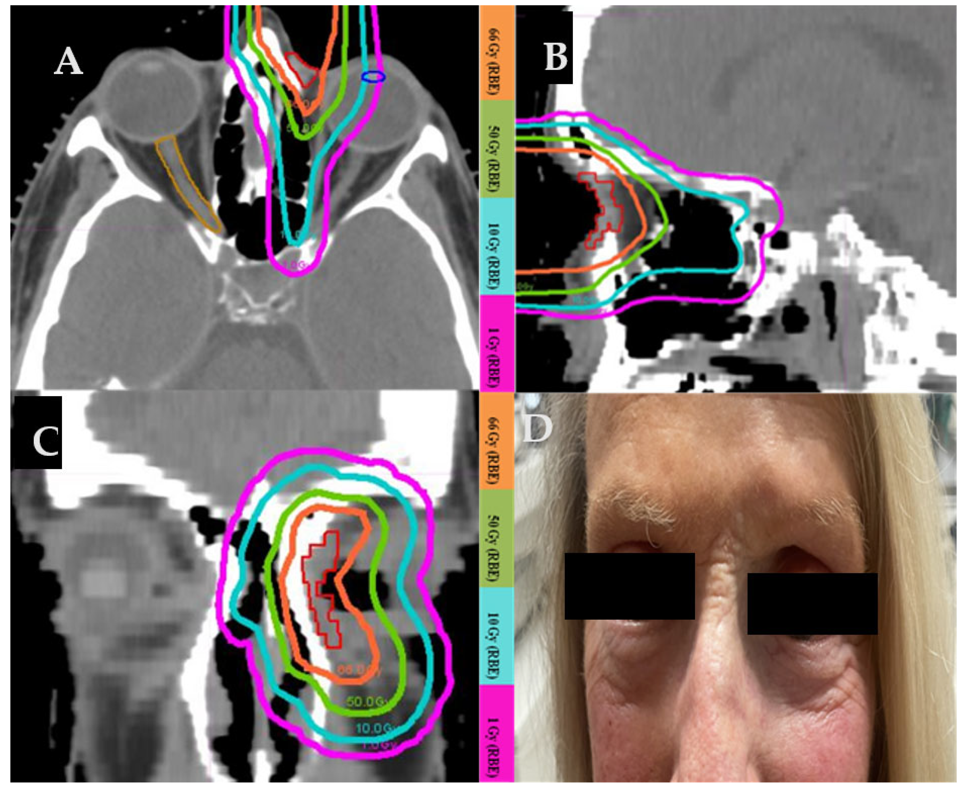 Cancers 17 00327 g002 Cancers 17 00327 g002