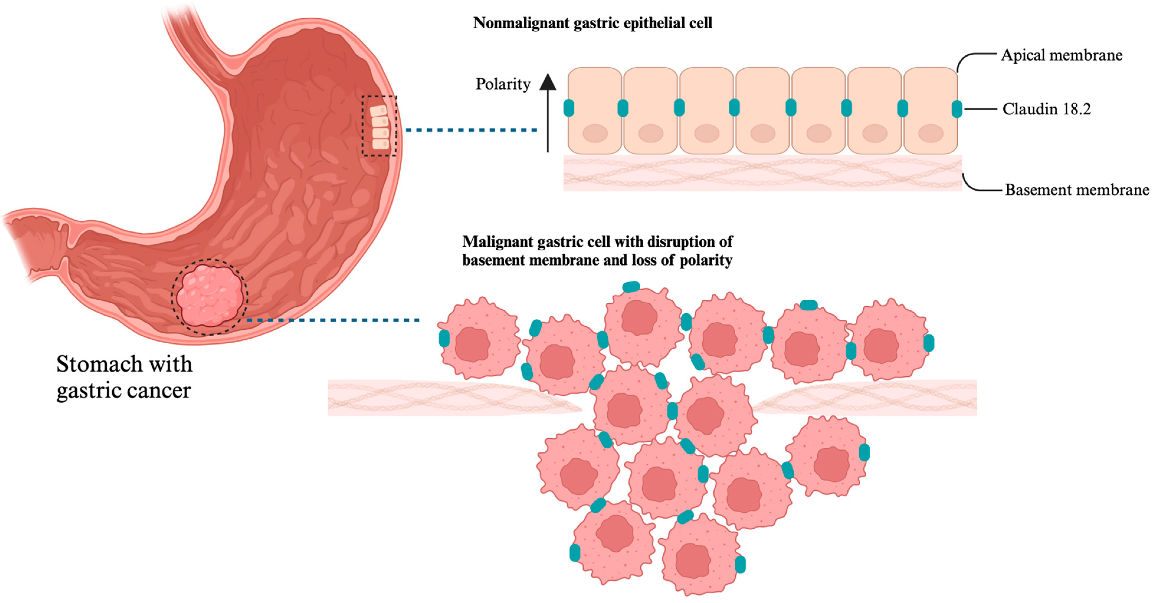 Cancers 17 00340 g002 Cancers 17 00340 g002