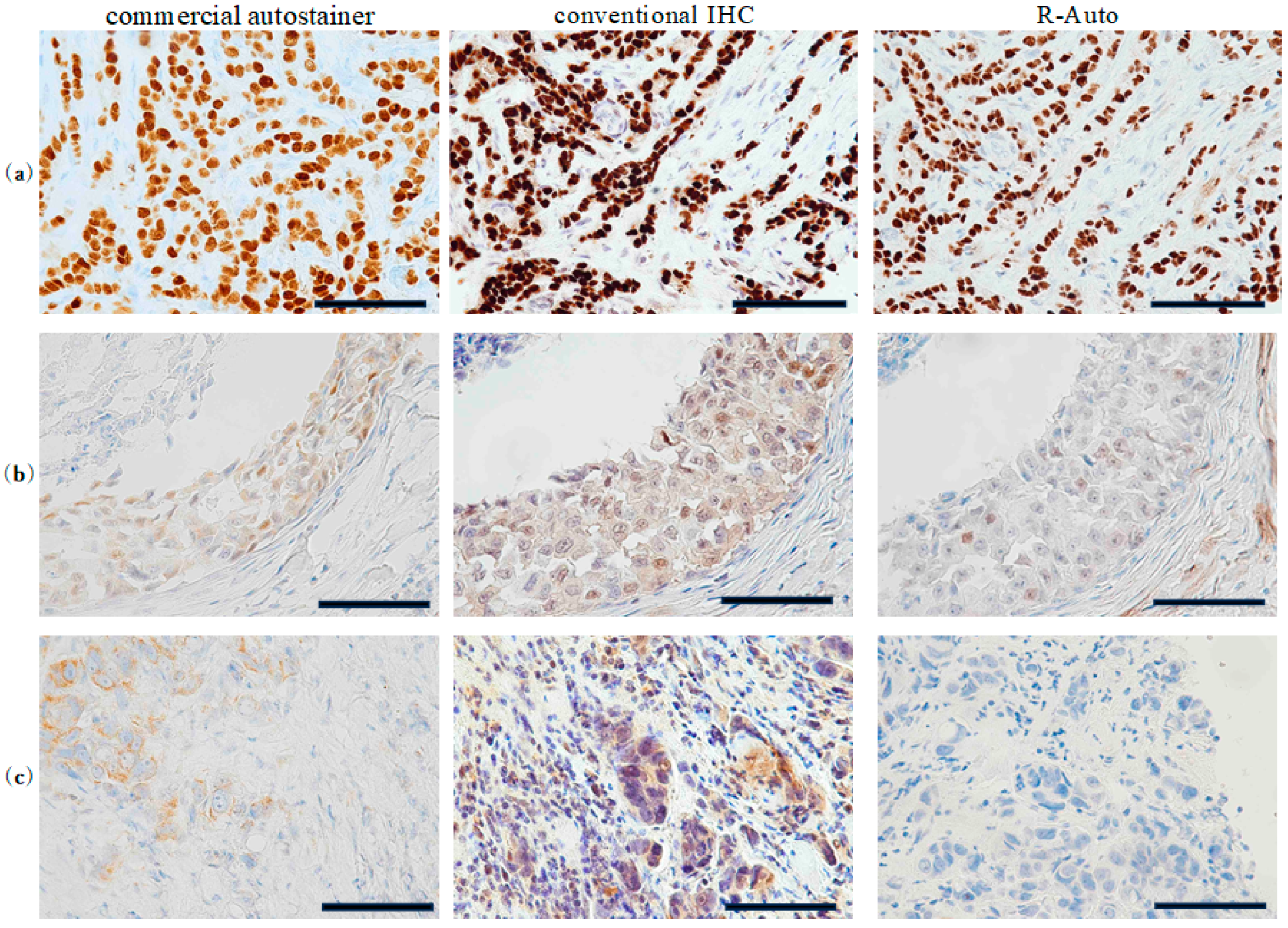 Cancers 17 00363 g003