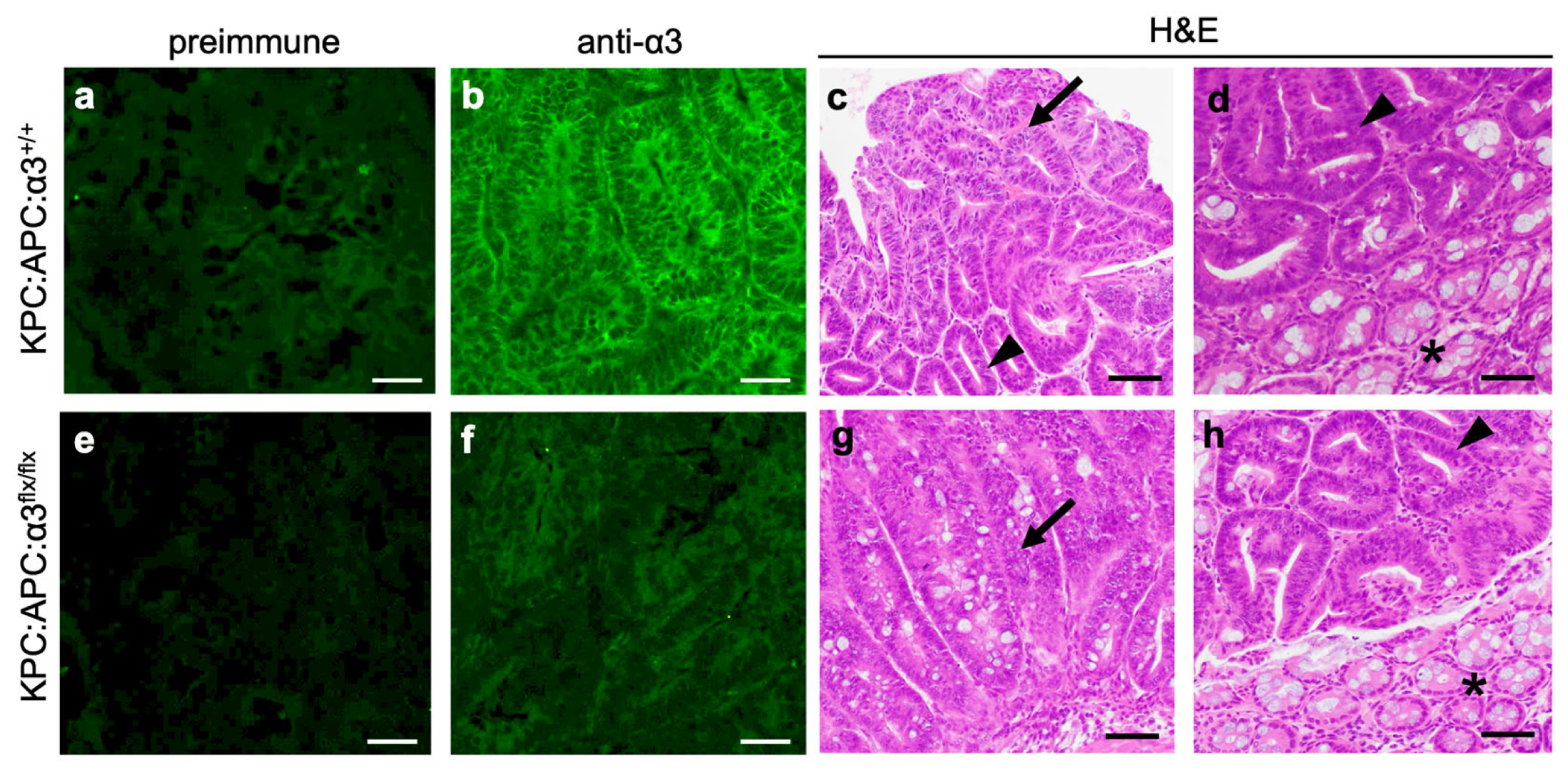 Cancers 17 00371 g004