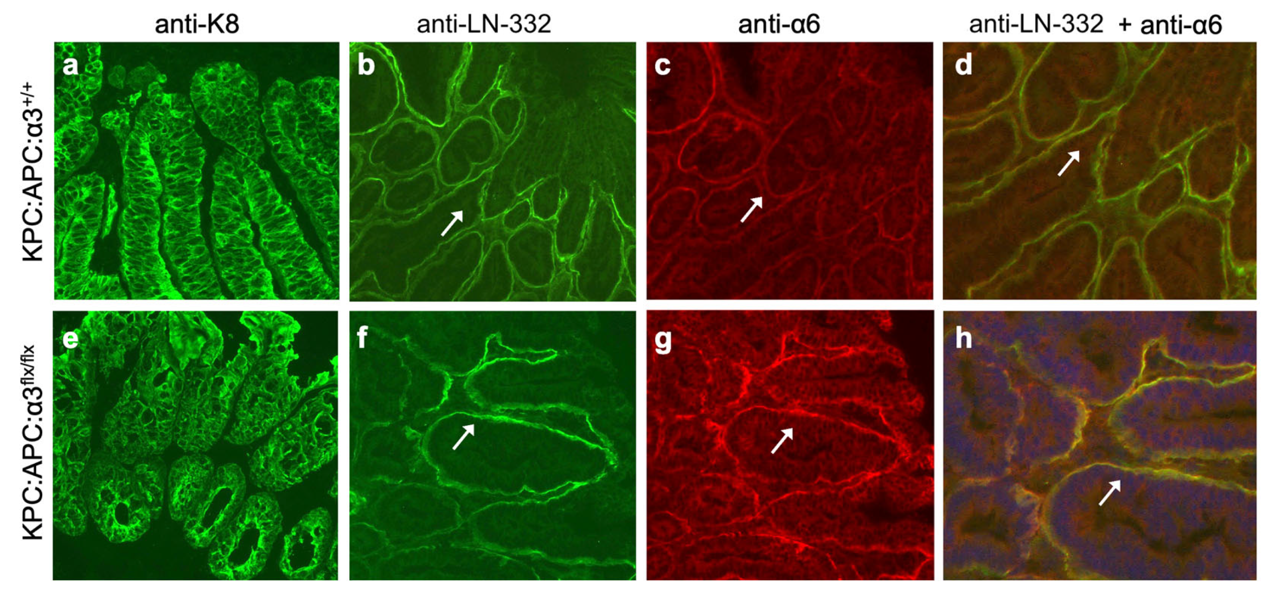 Cancers 17 00371 g005