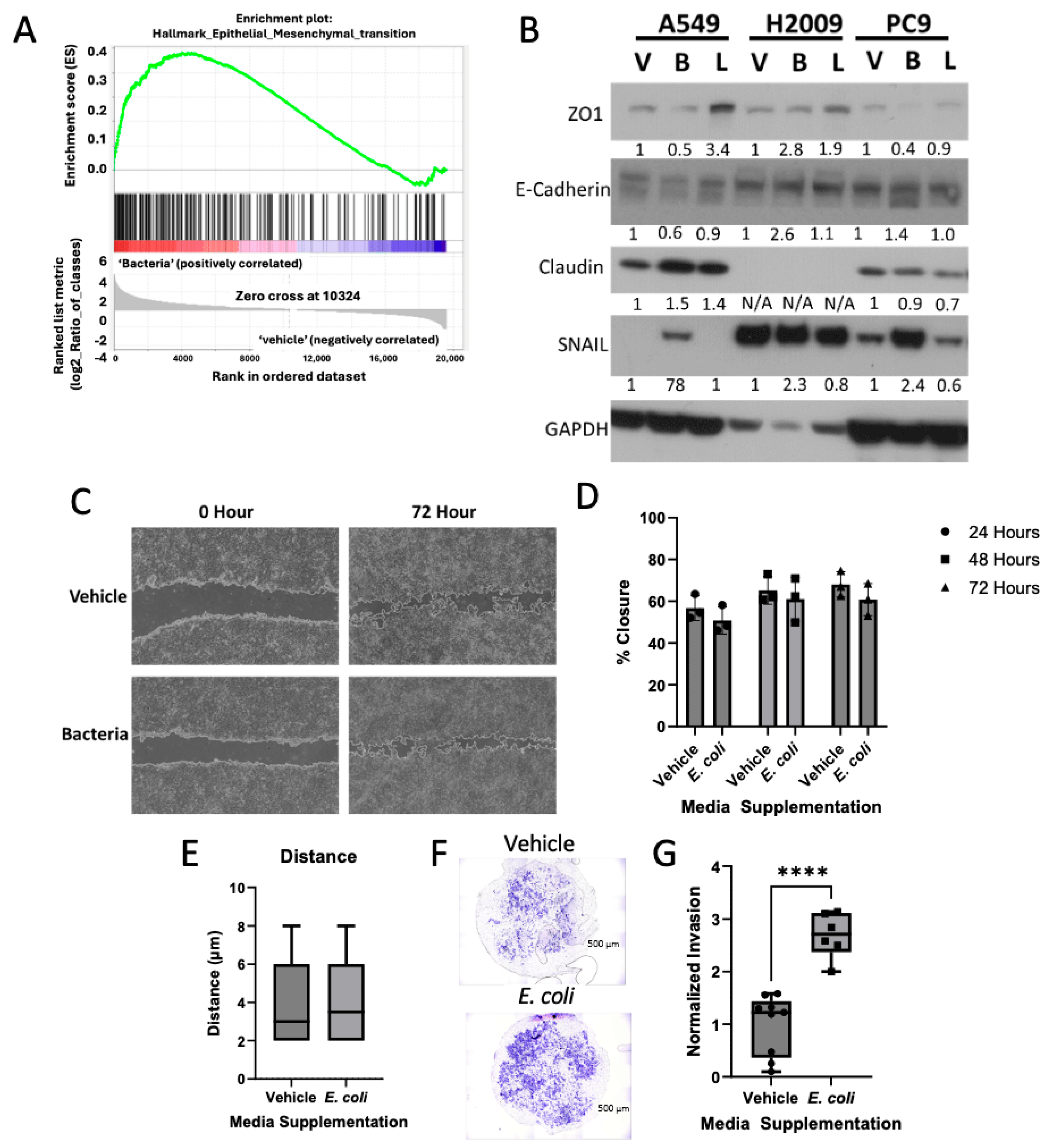 Cancers 17 00380 g004