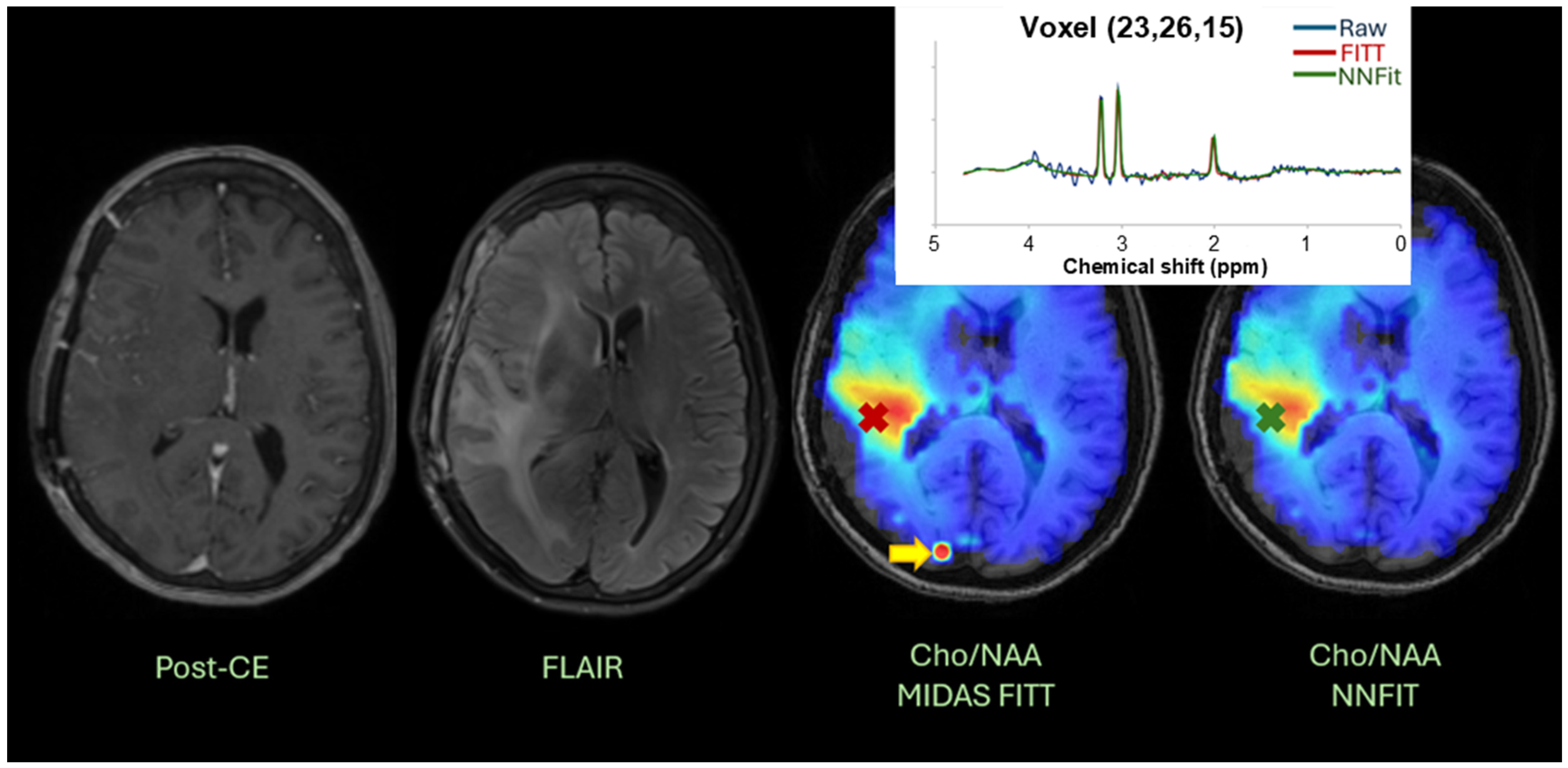 Cancers 17 00423 g007