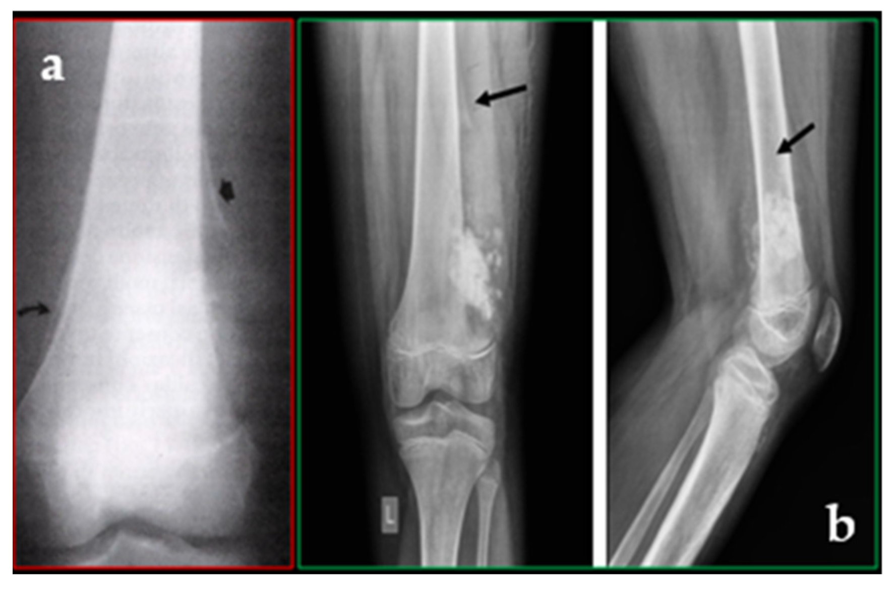 Cancers 17 00451 g001