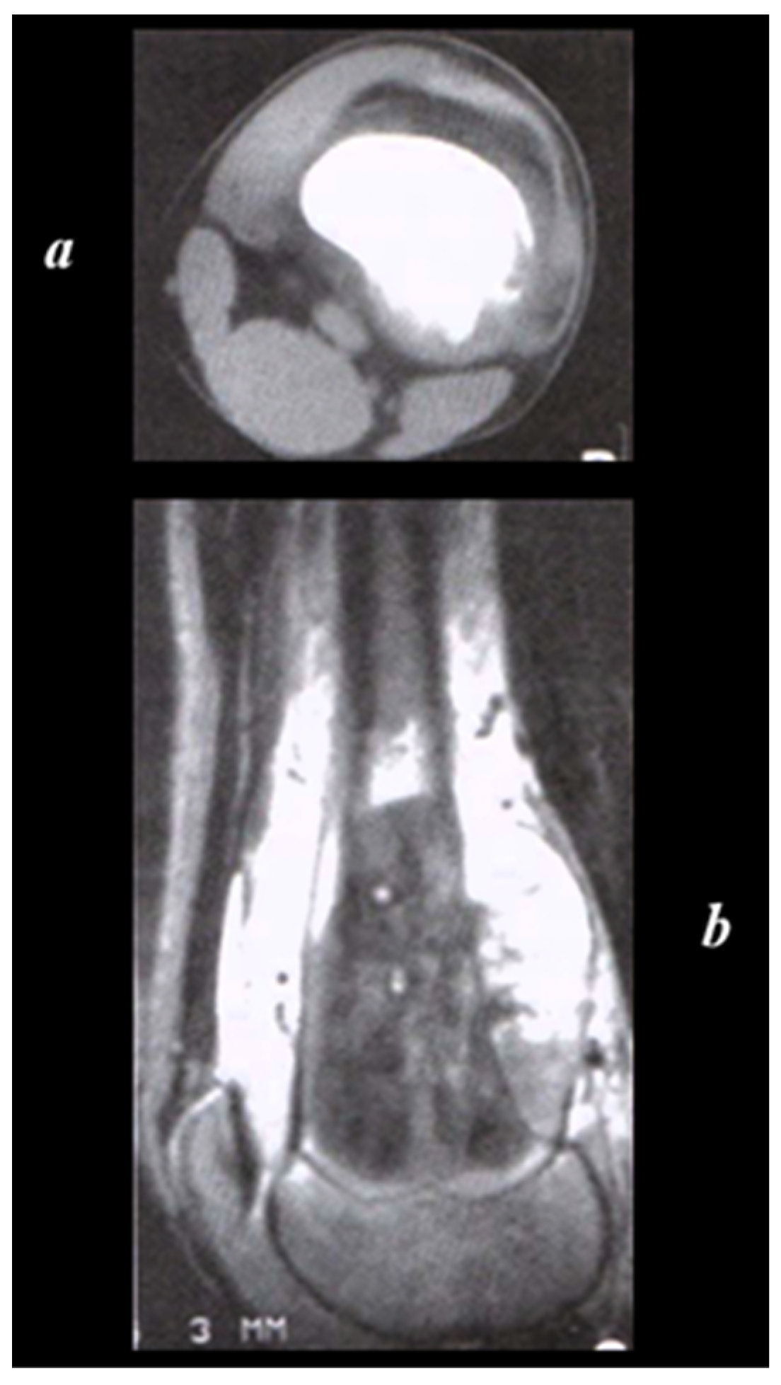 Cancers 17 00451 g002