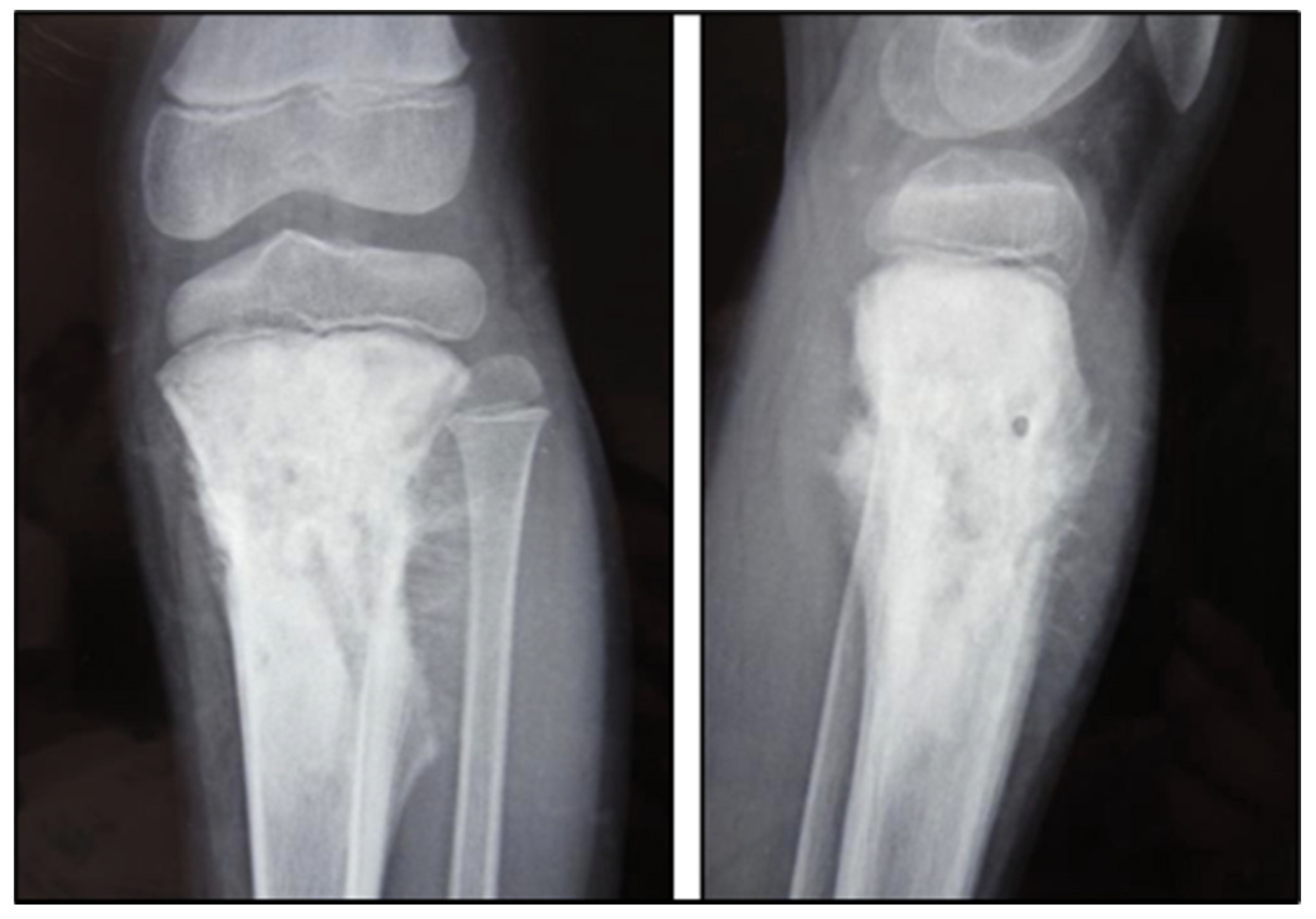 Cancers 17 00451 g003