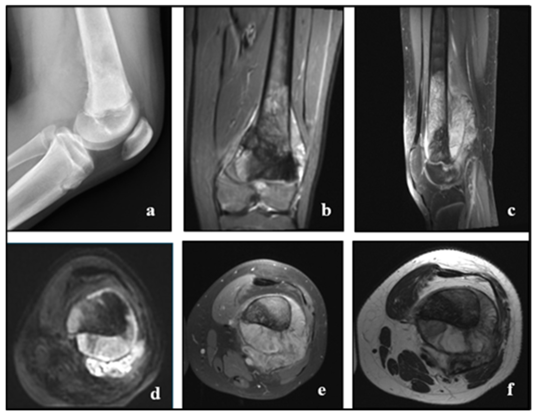 Cancers 17 00451 g004