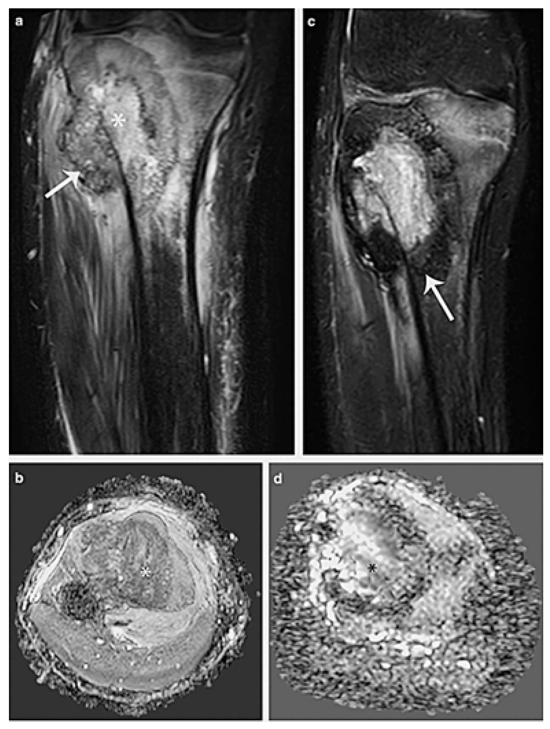 Cancers 17 00451 g005