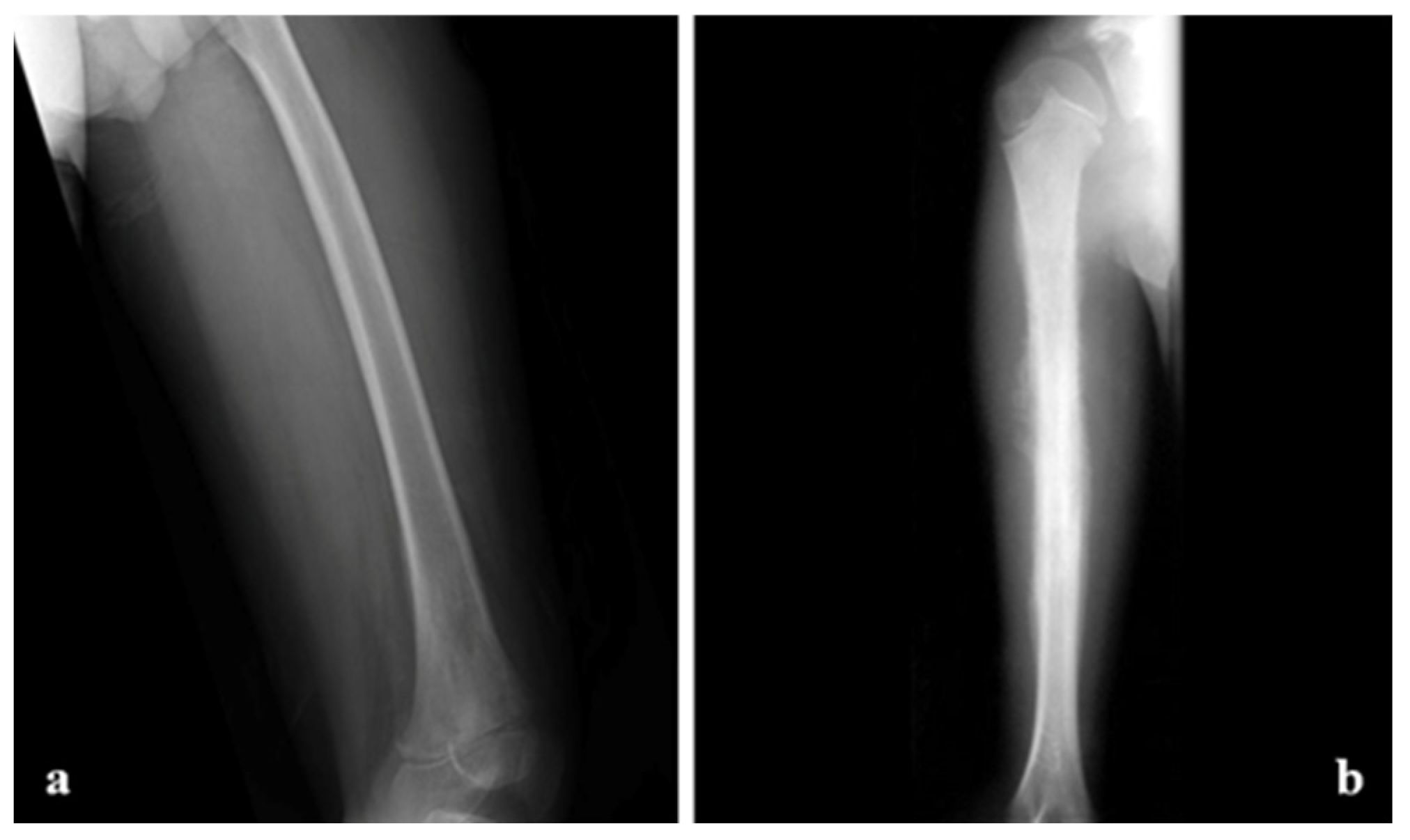 Cancers 17 00451 g006