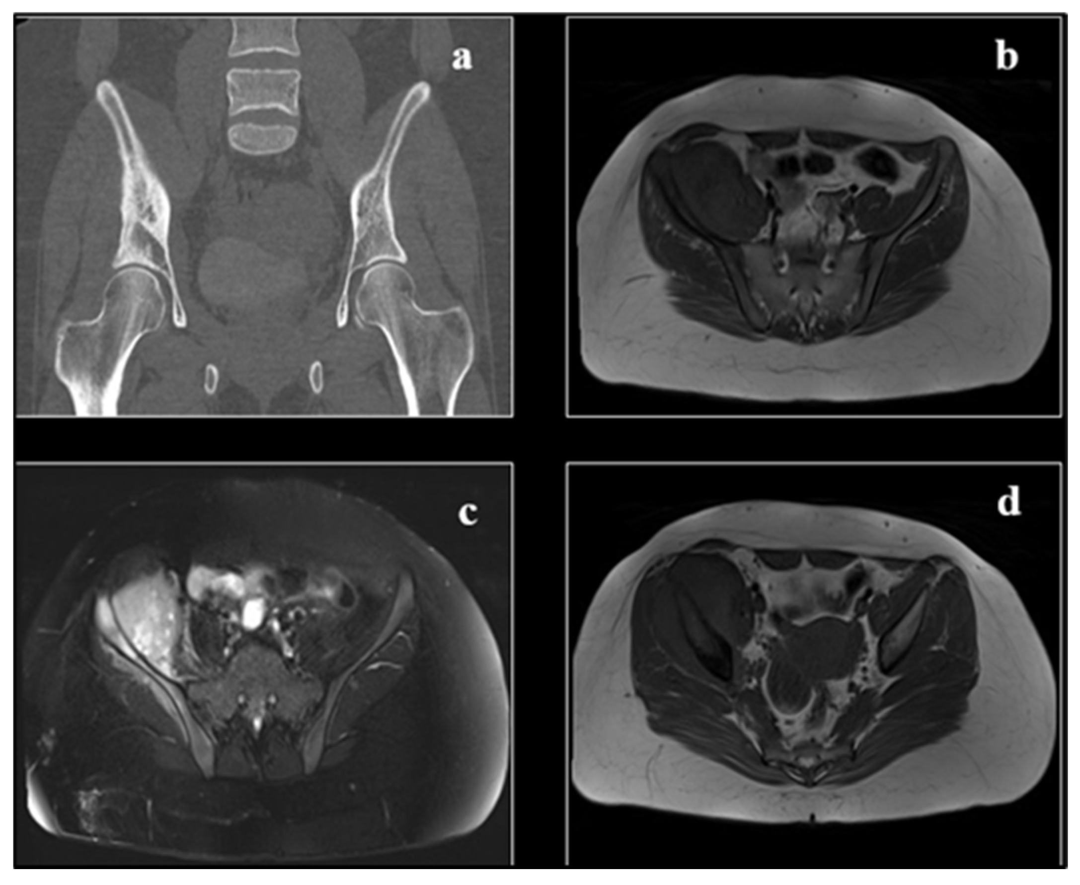 Cancers 17 00451 g007