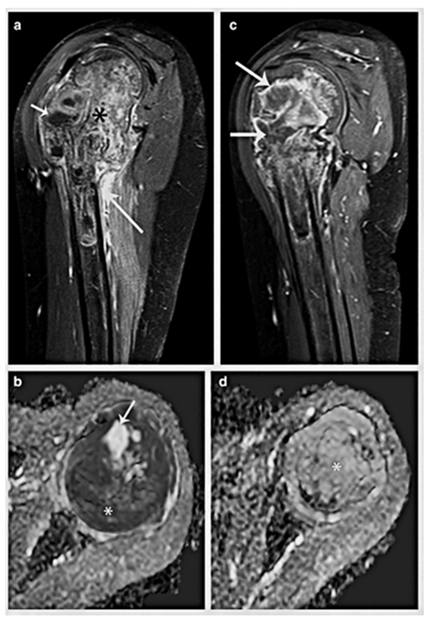 Cancers 17 00451 g008