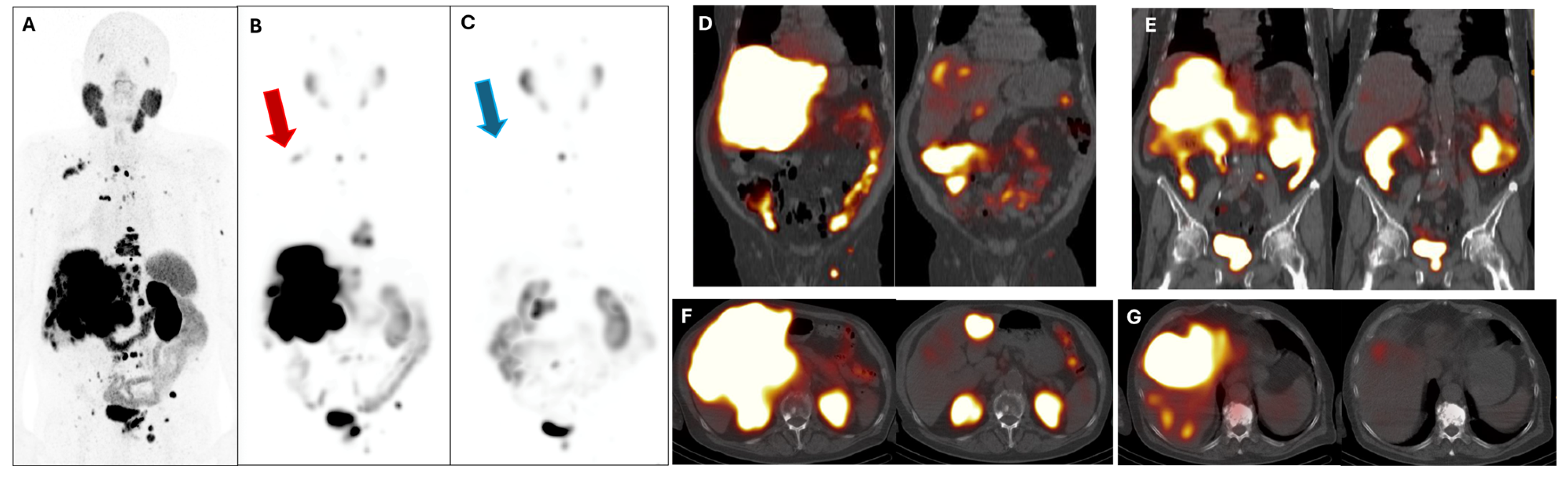 Cancers 17 00476 g004