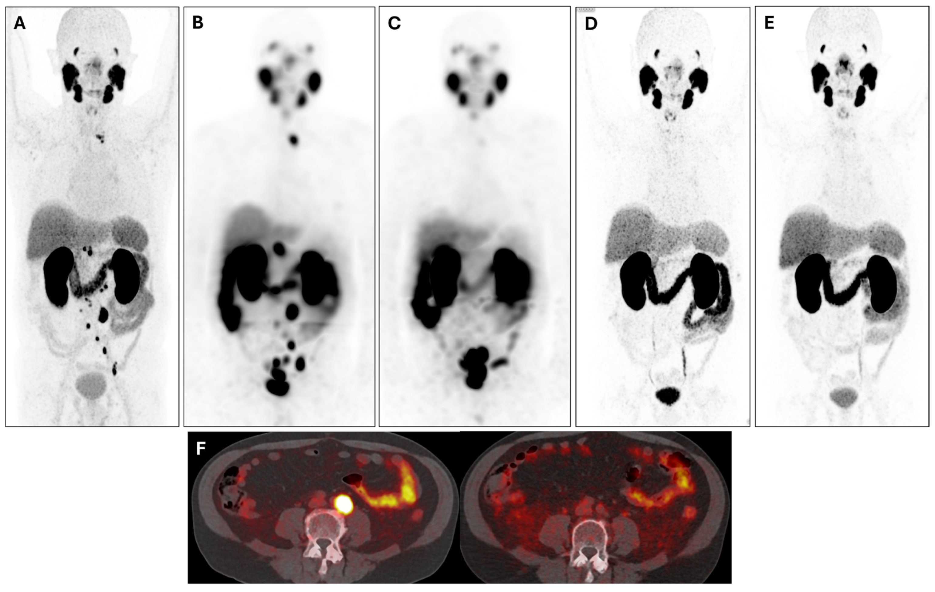 Cancers 17 00476 g005
