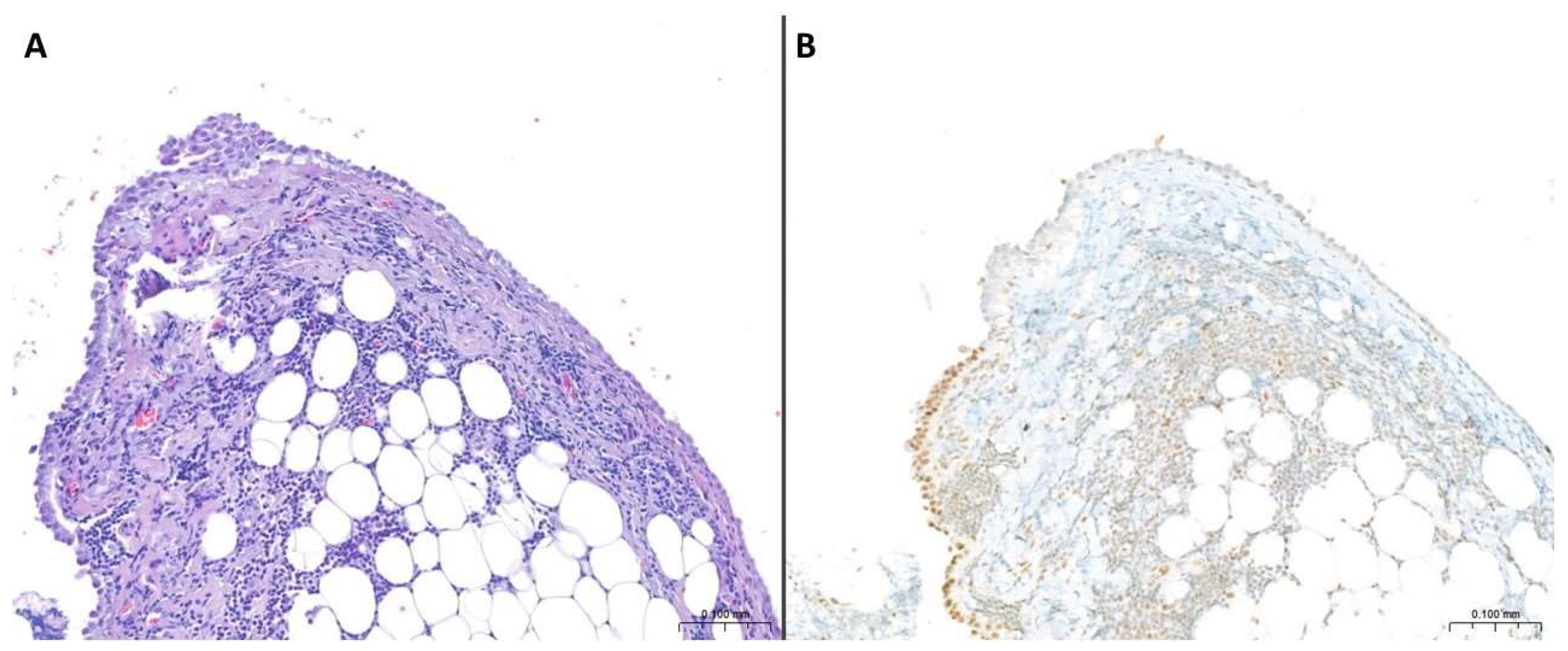 Cancers 17 00481 g001