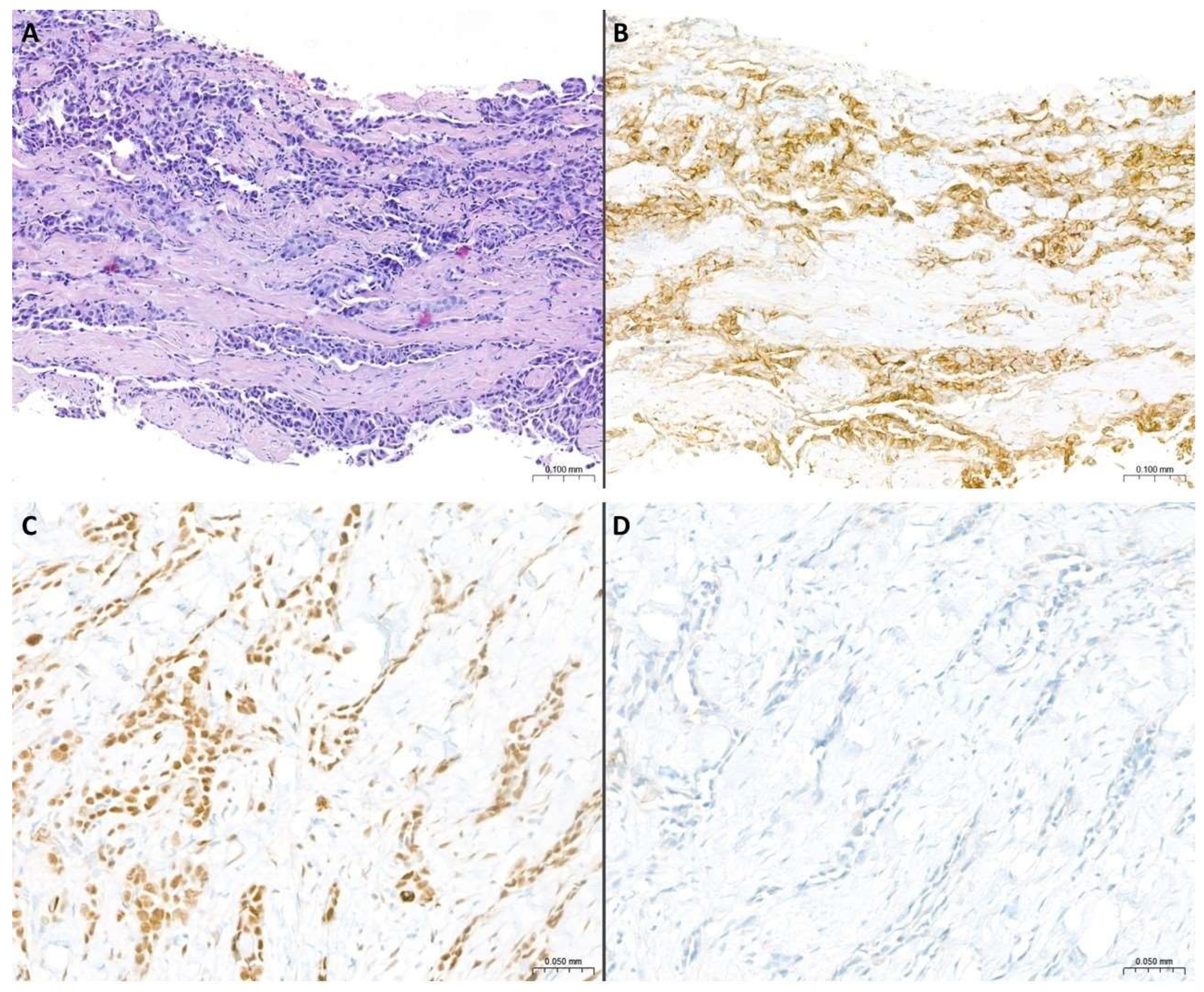 Cancers 17 00481 g002