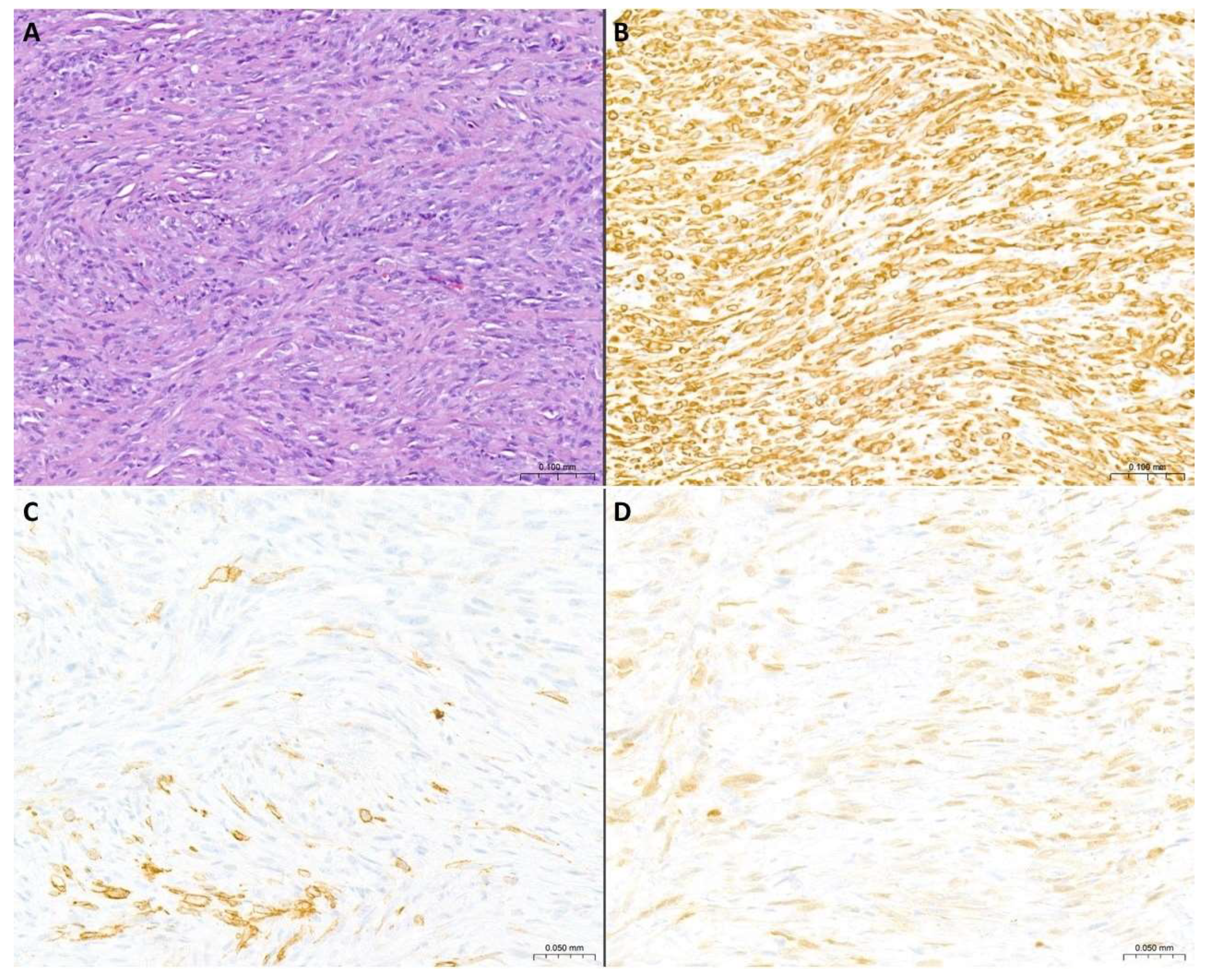 Cancers 17 00481 g003