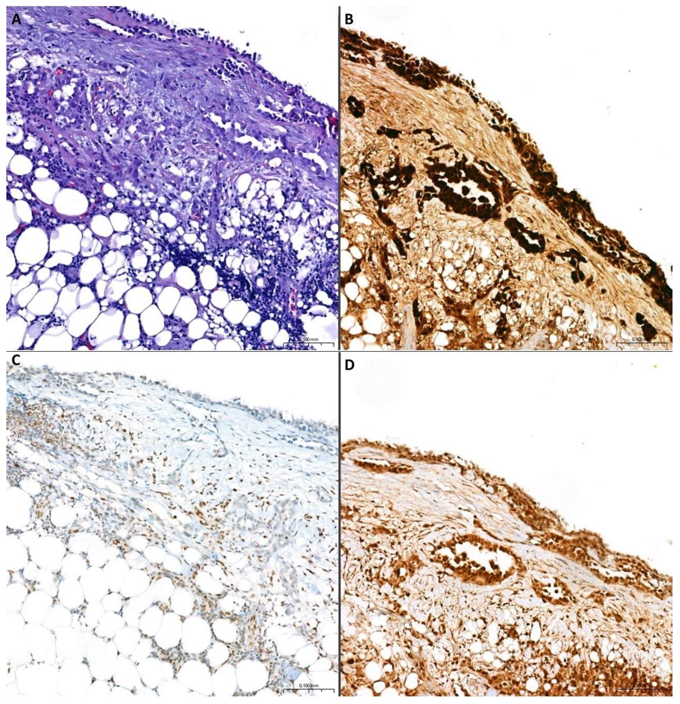 Cancers 17 00481 g004