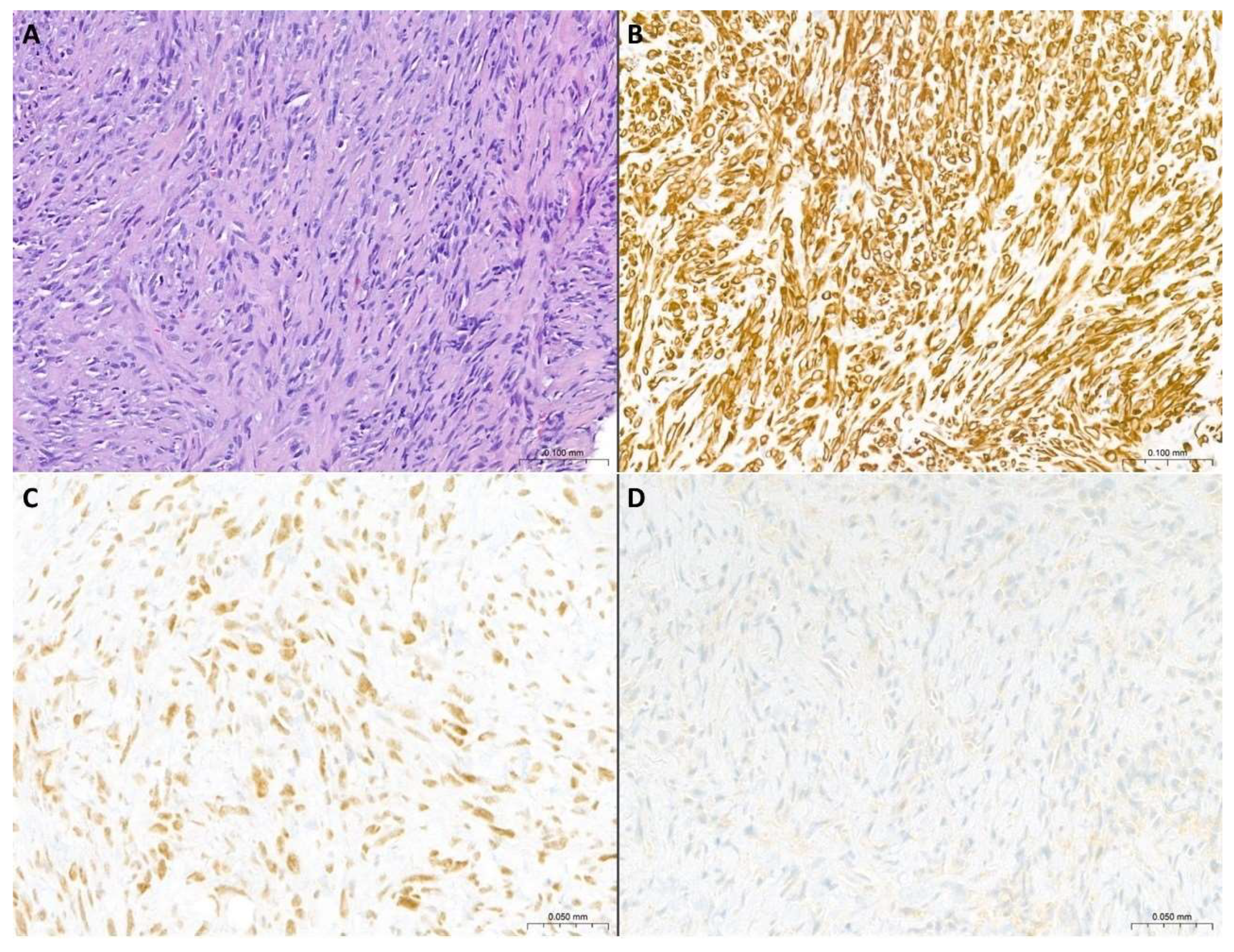 Cancers 17 00481 g005