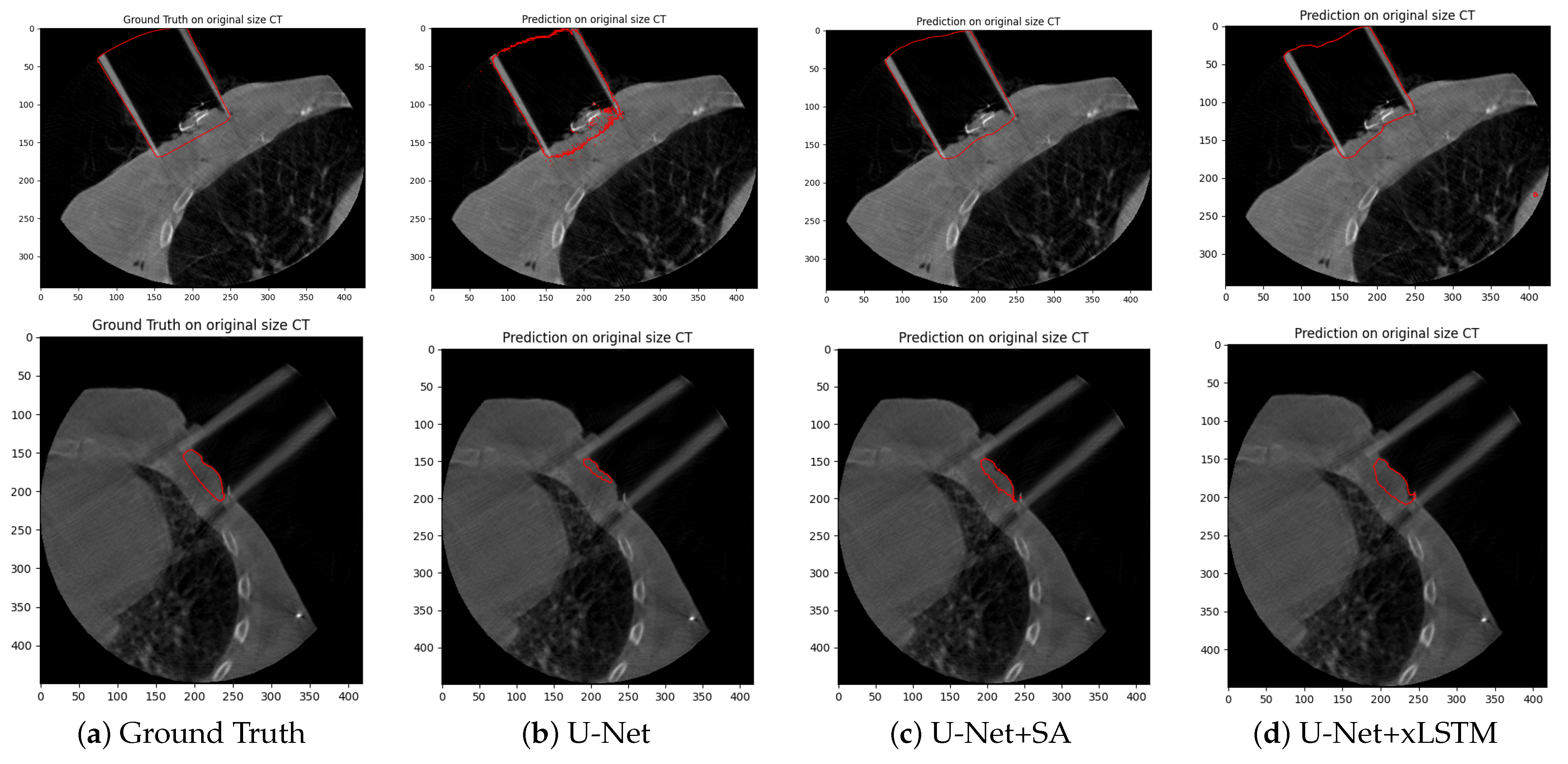 Cancers 17 00485 g004