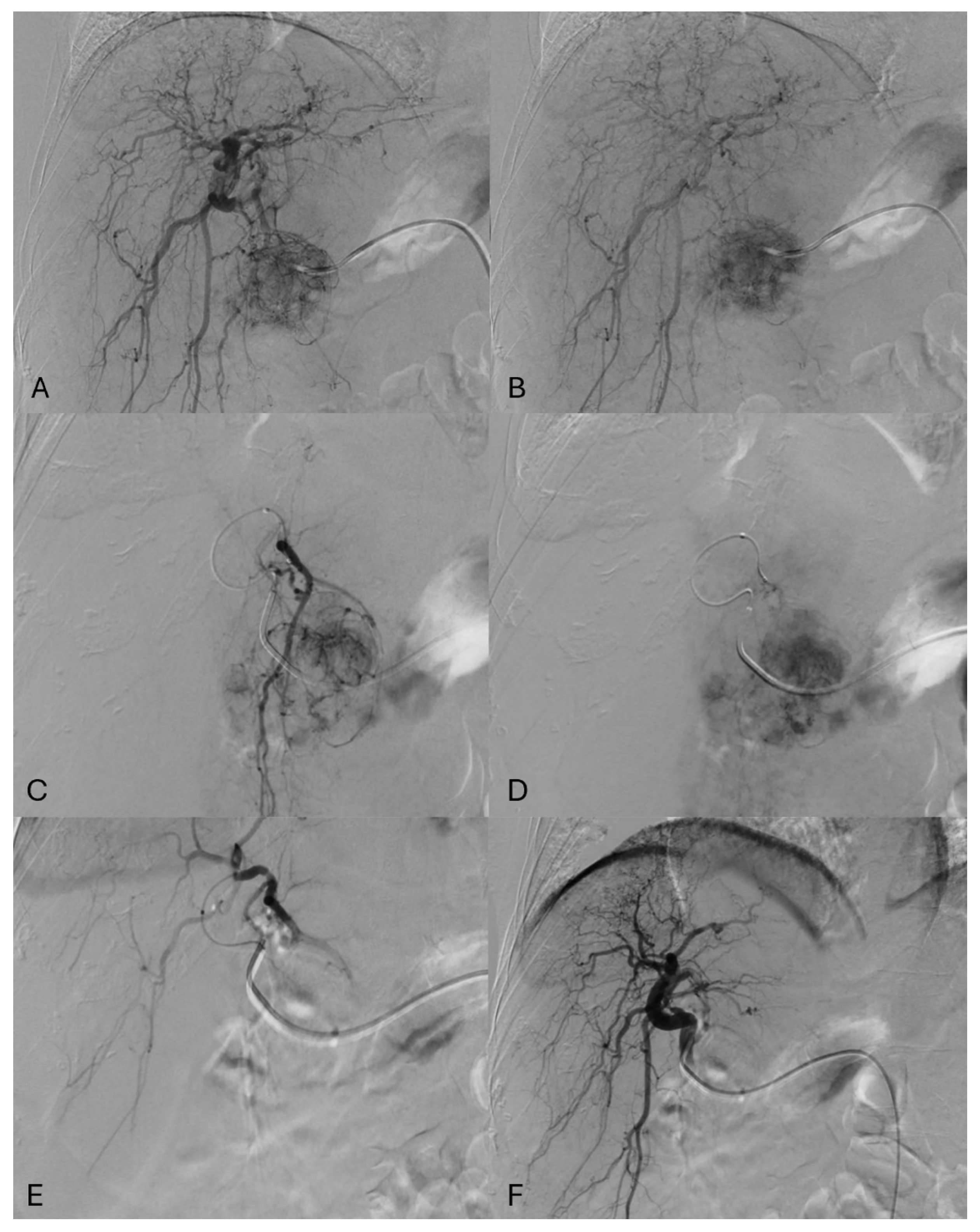 Cancers 17 00492 g001