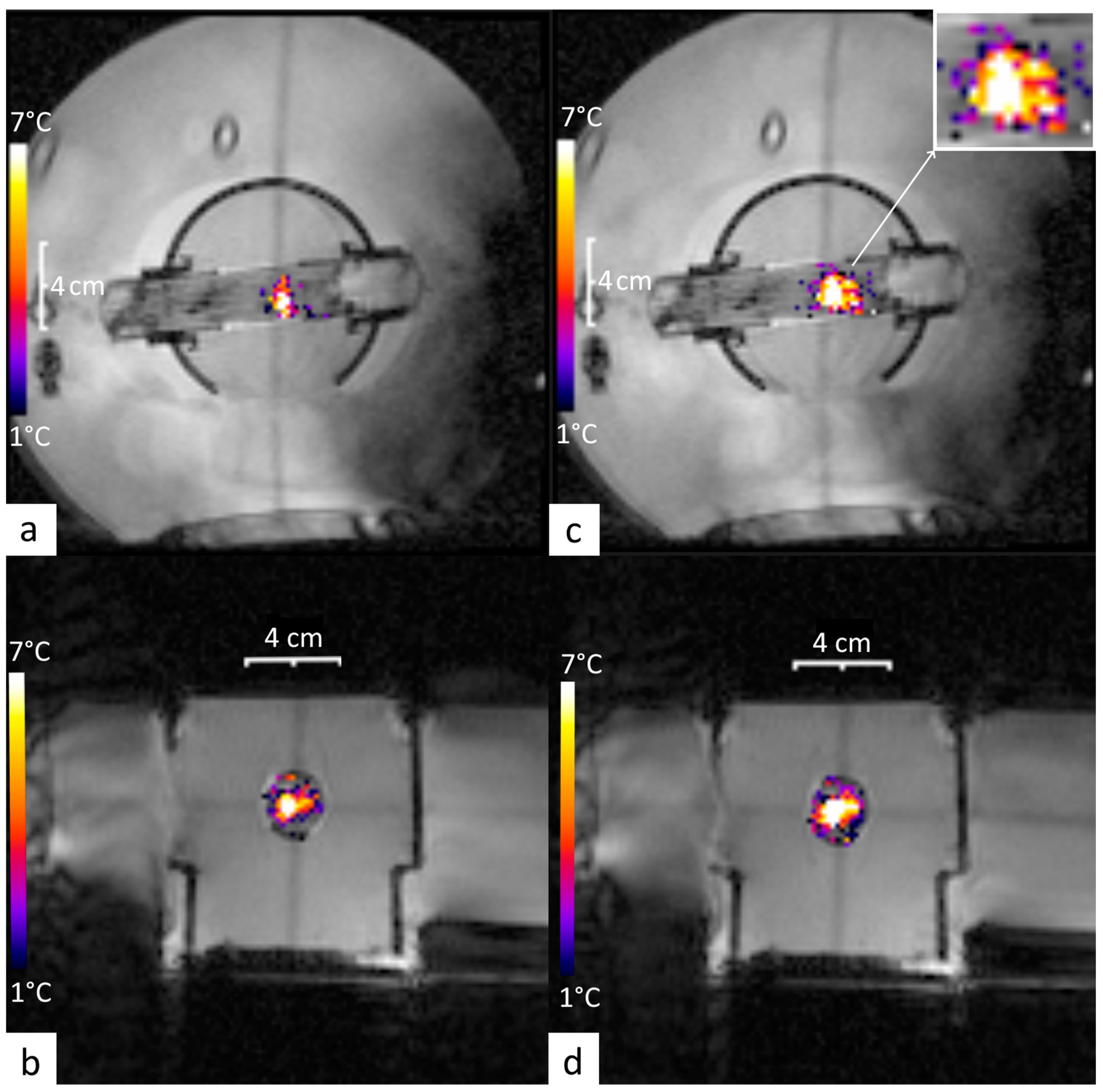 Cancers 17 00515 g004