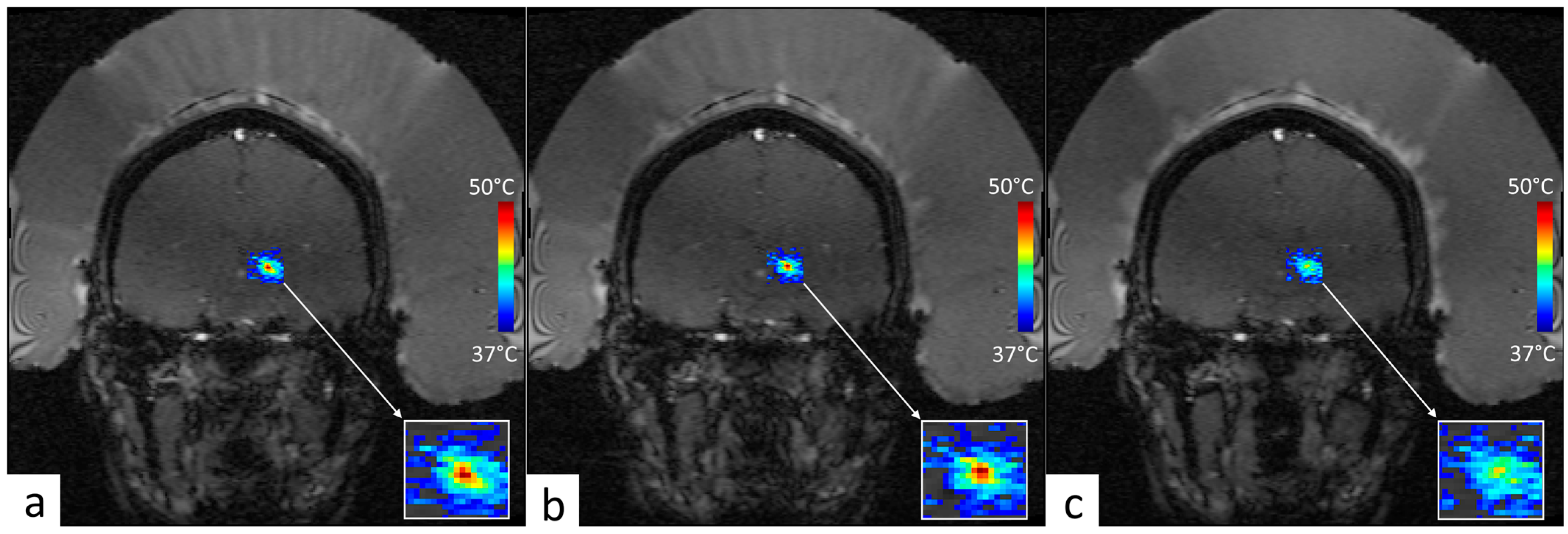 Cancers 17 00515 g006