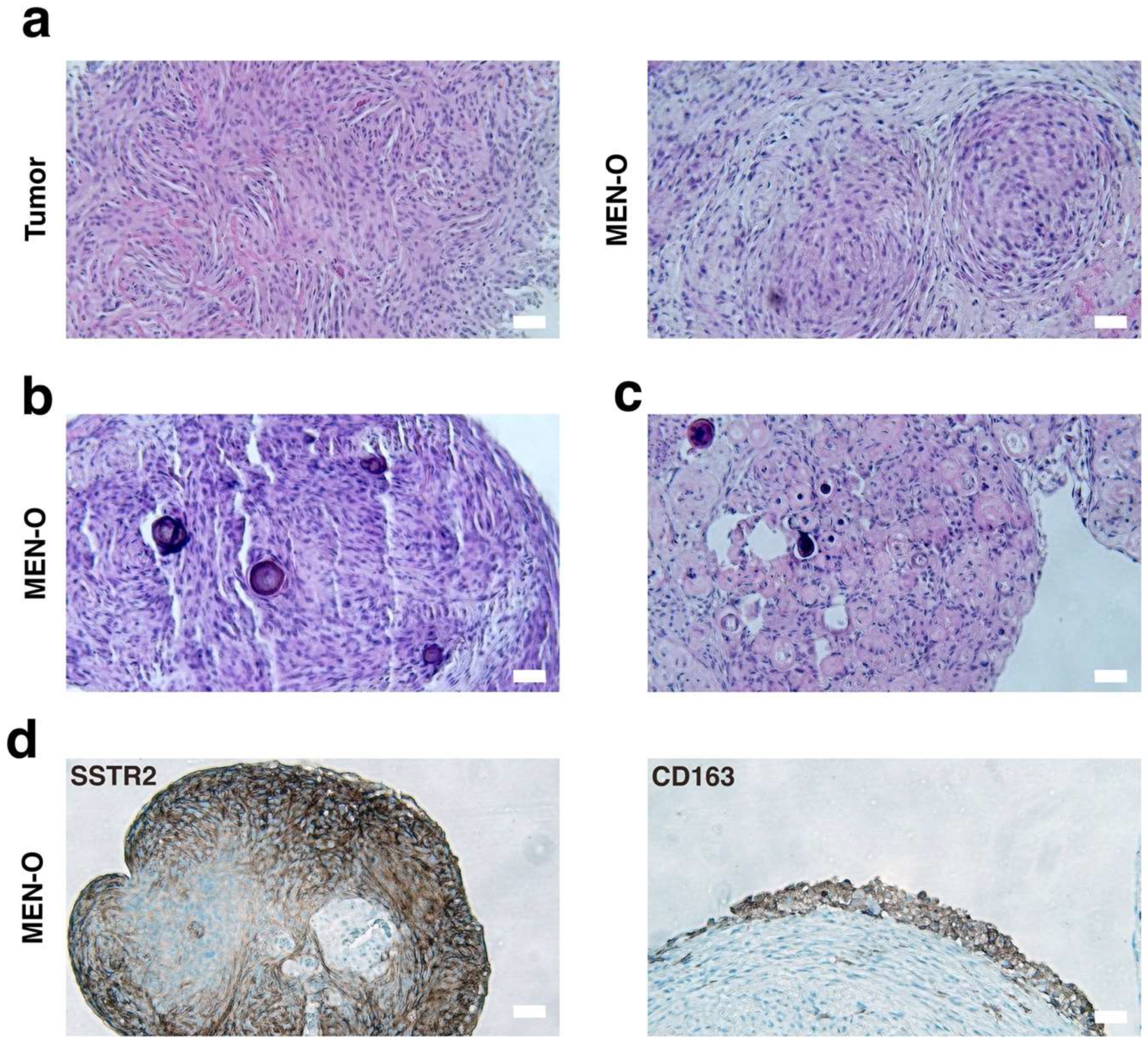 Cancers 17 00526 g002