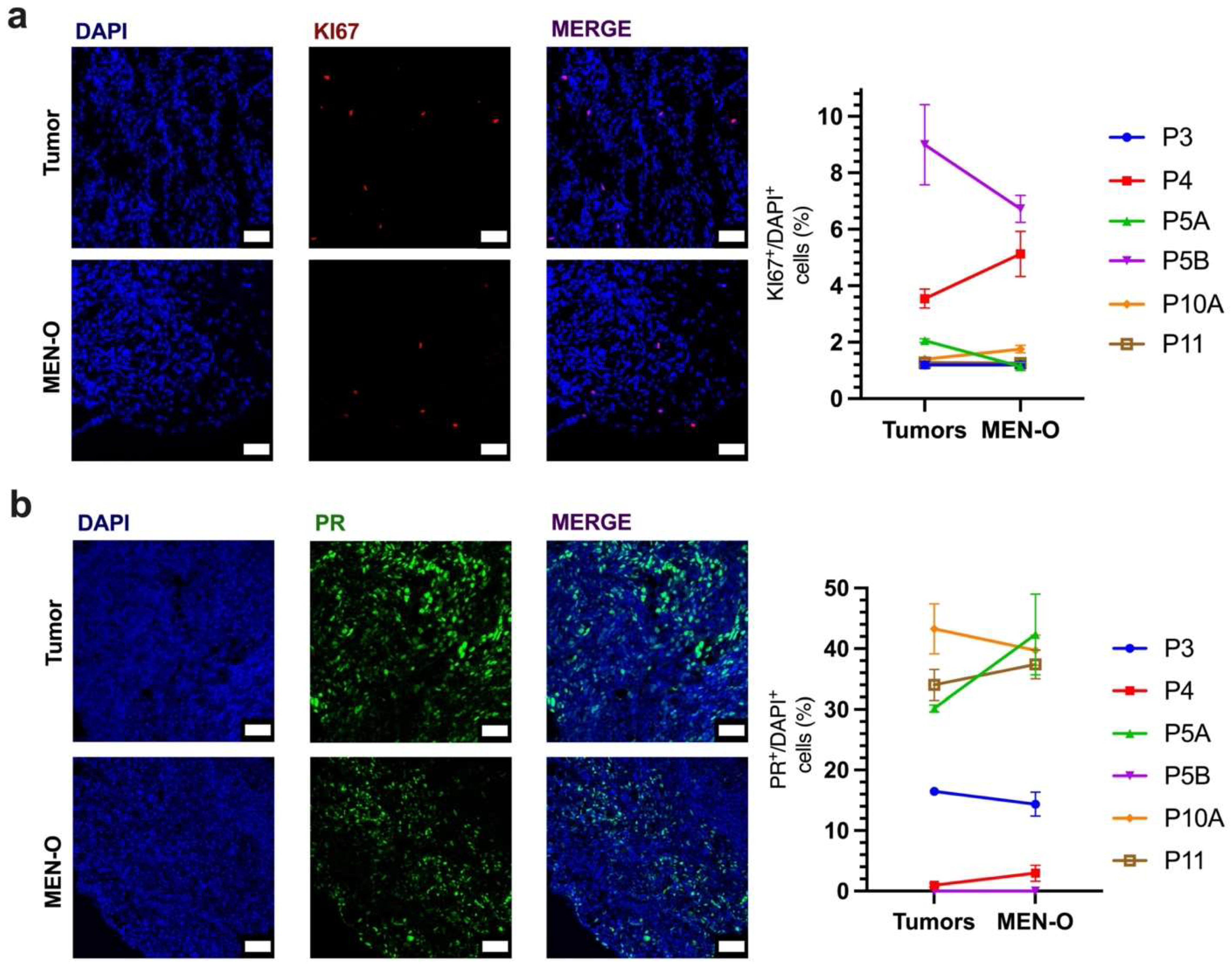 Cancers 17 00526 g003