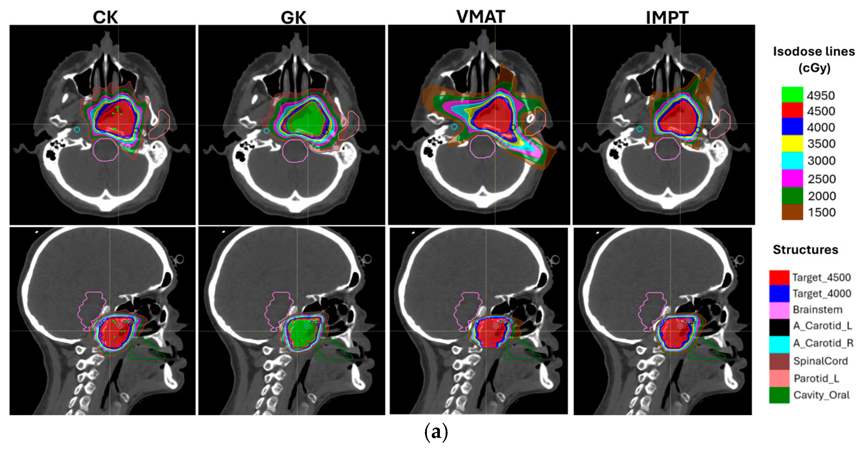 Advanced External Beam Stereotactic Radiotherapy for Skull Advanced External Beam Stereotactic Radiotherapy for Skull