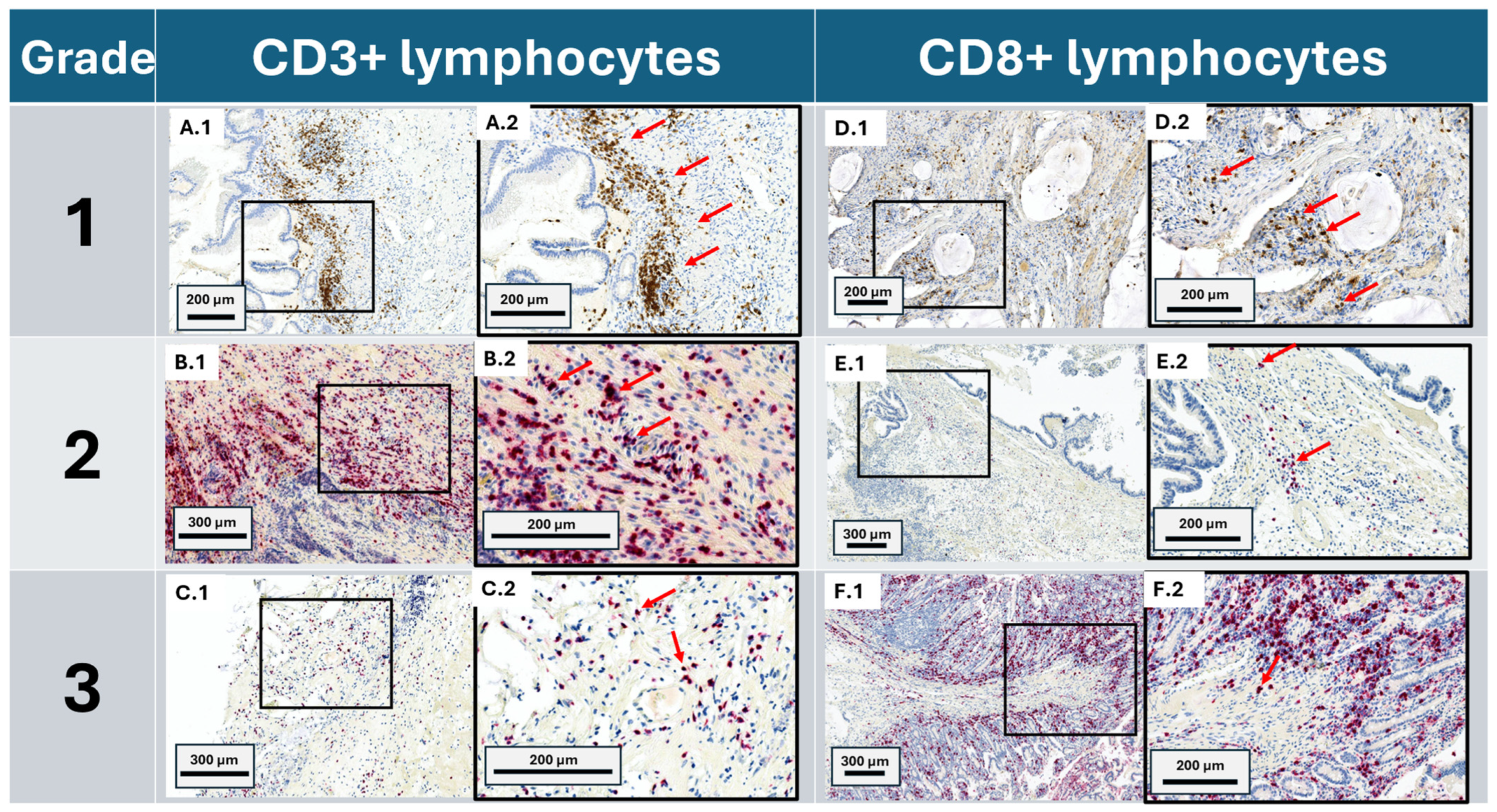 Cancers 17 00542 g001