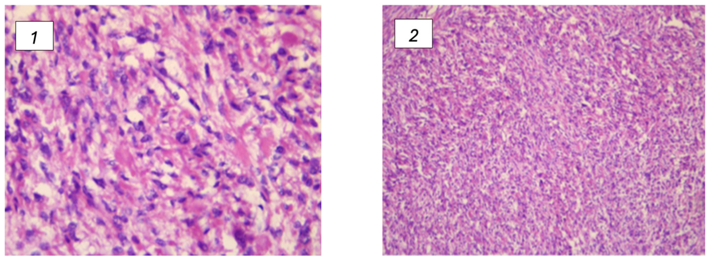 Cancers 17 00573 g002