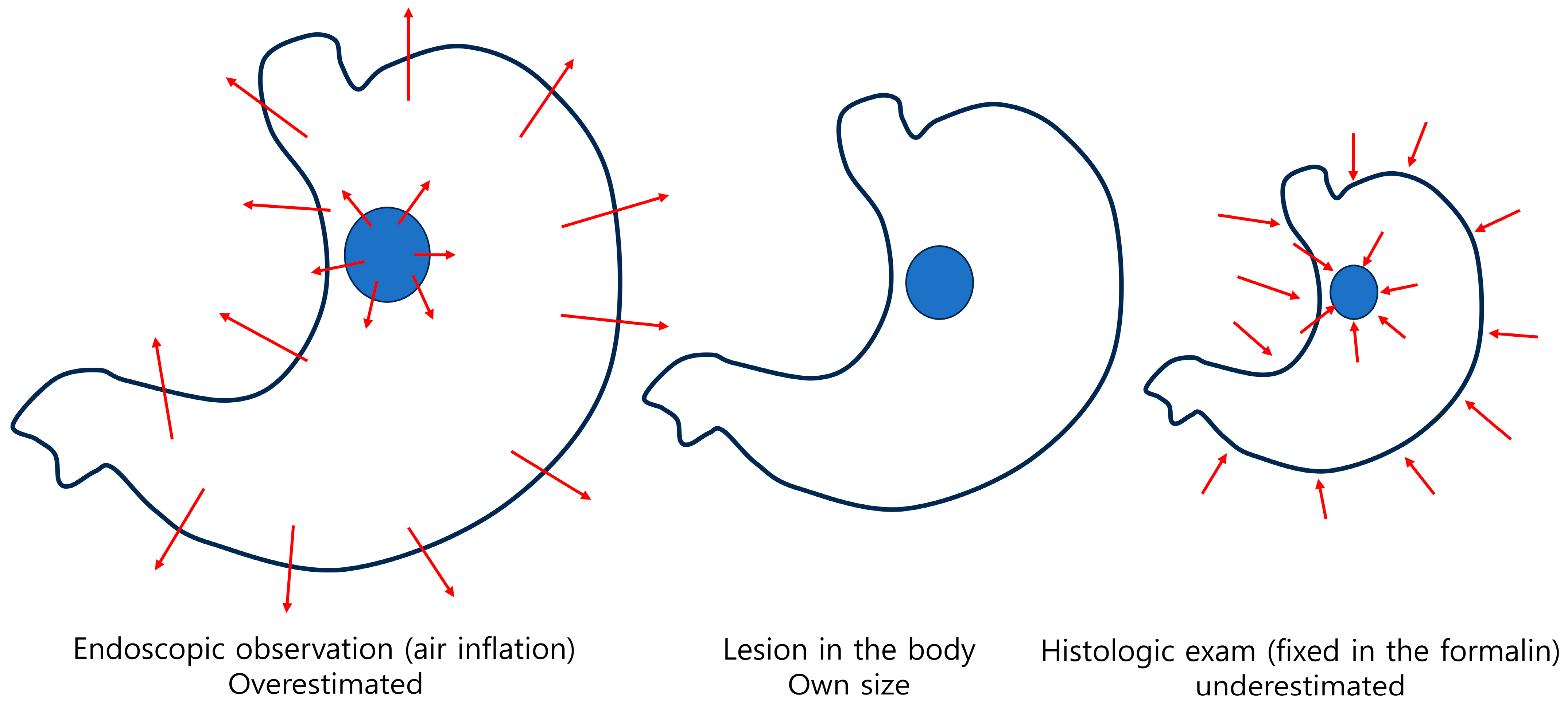 Cancers 17 00602 g002