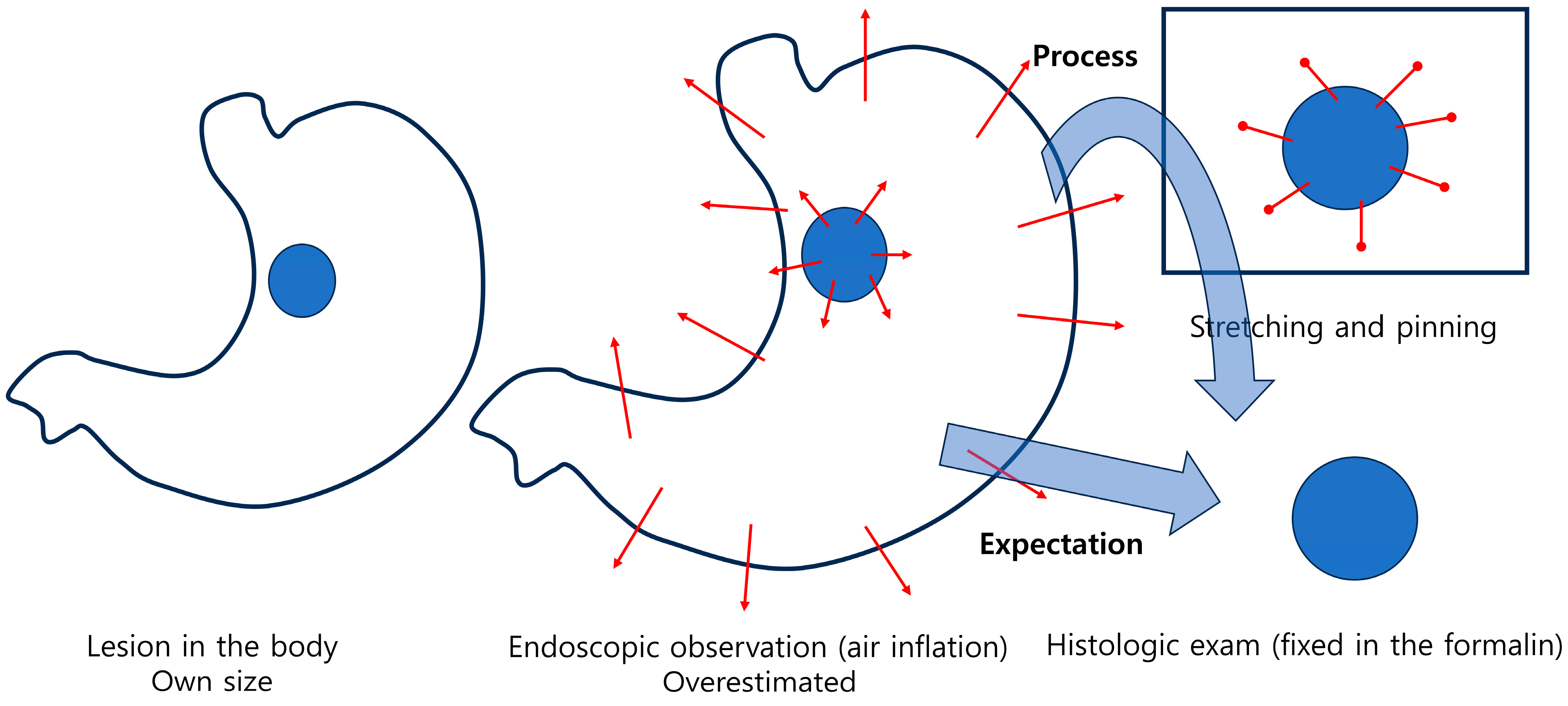 Cancers 17 00602 g003
