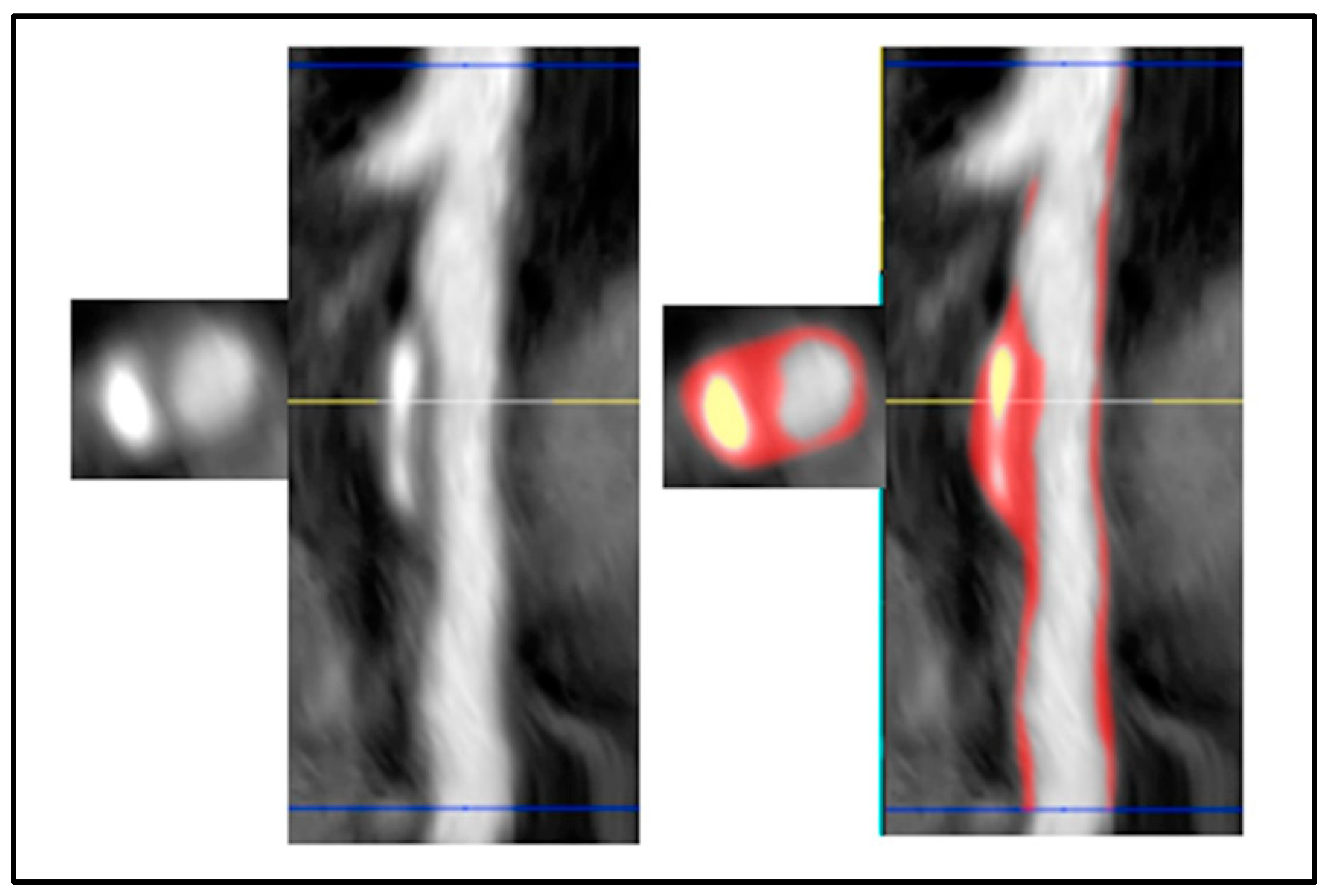 Cancers 17 00605 g005