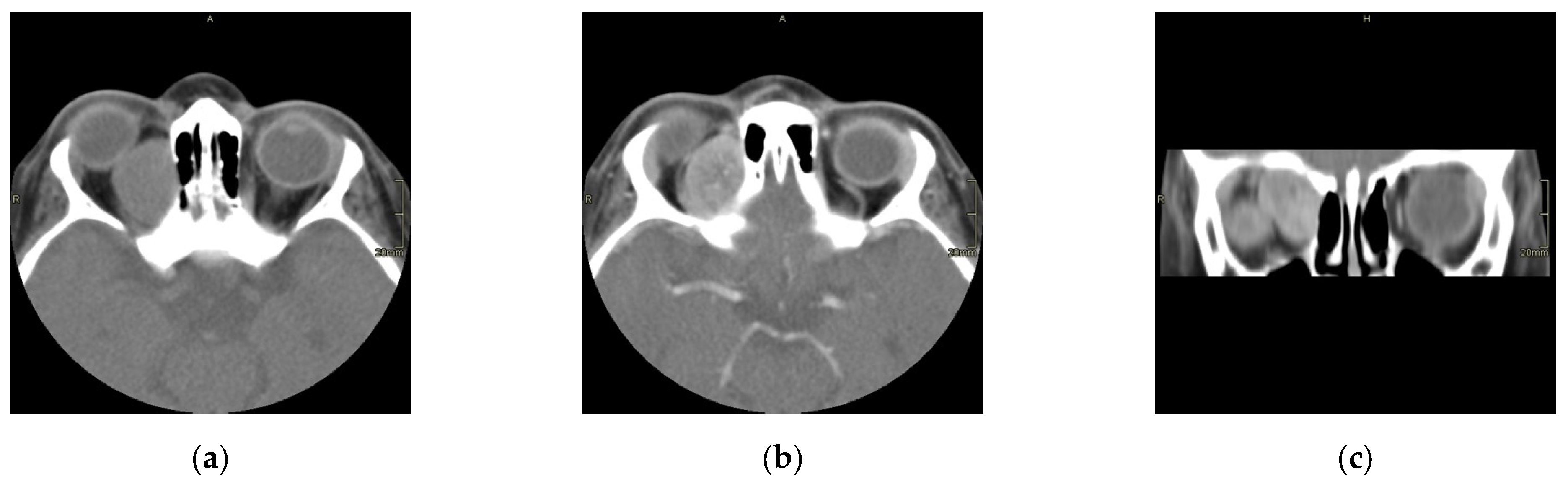 Cancers 17 00615 g001