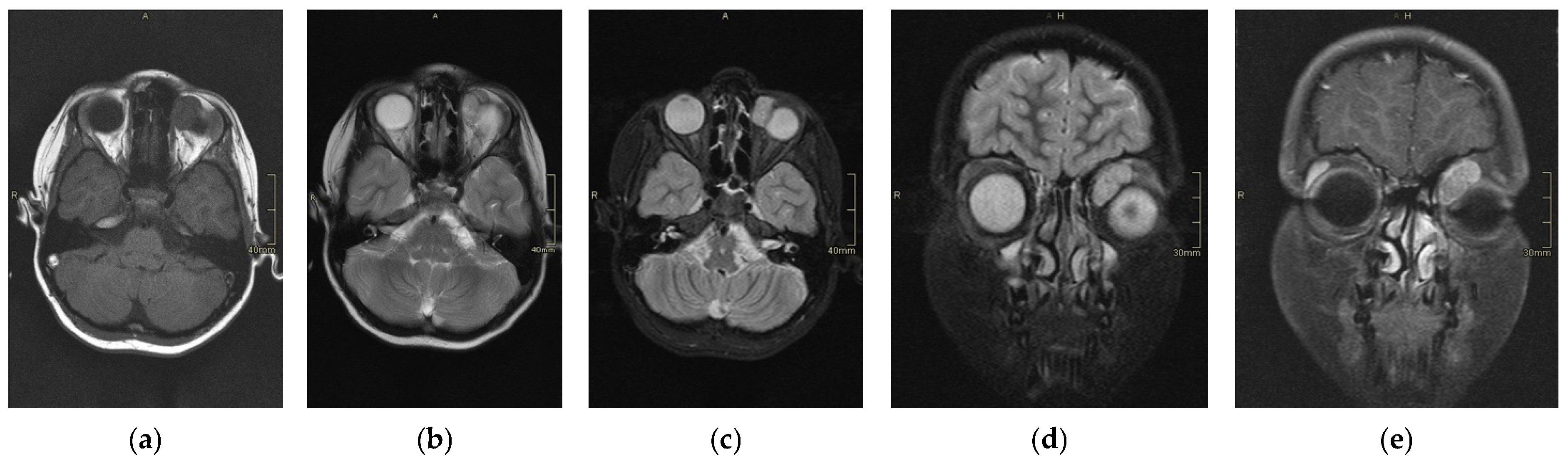 Cancers 17 00615 g002