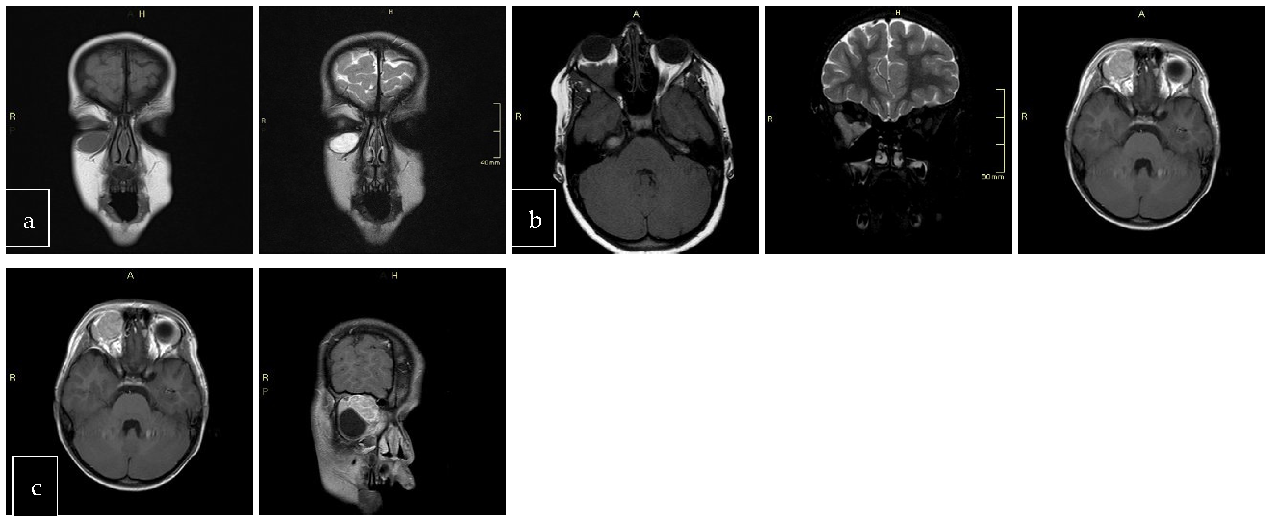 Cancers 17 00615 g003