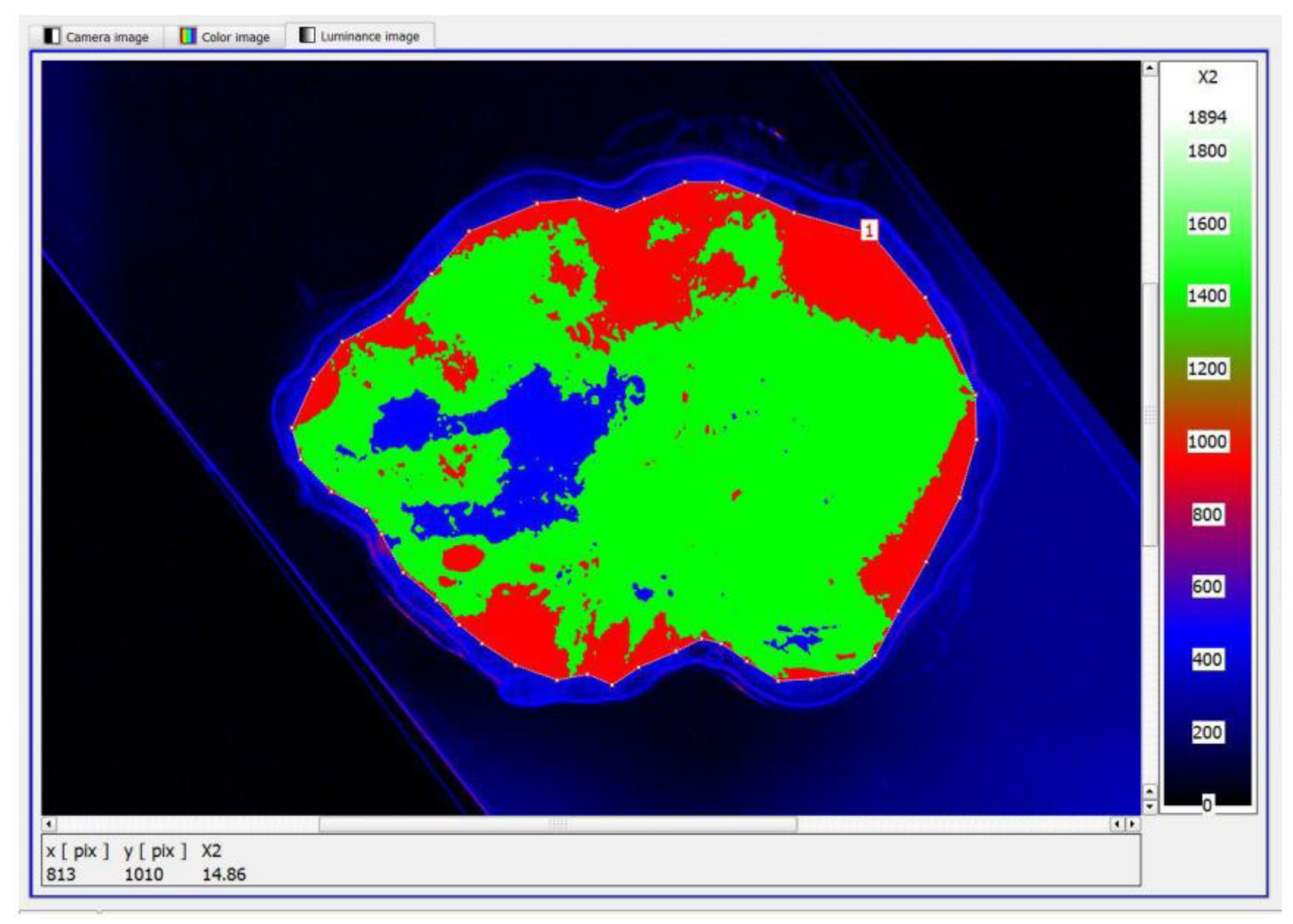 Cancers 17 00639 g009